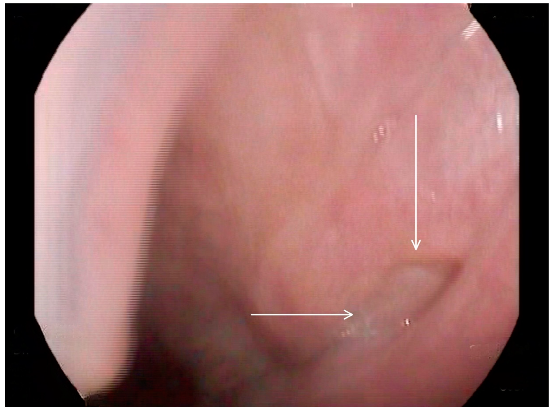 Medicina 60 01628 g005