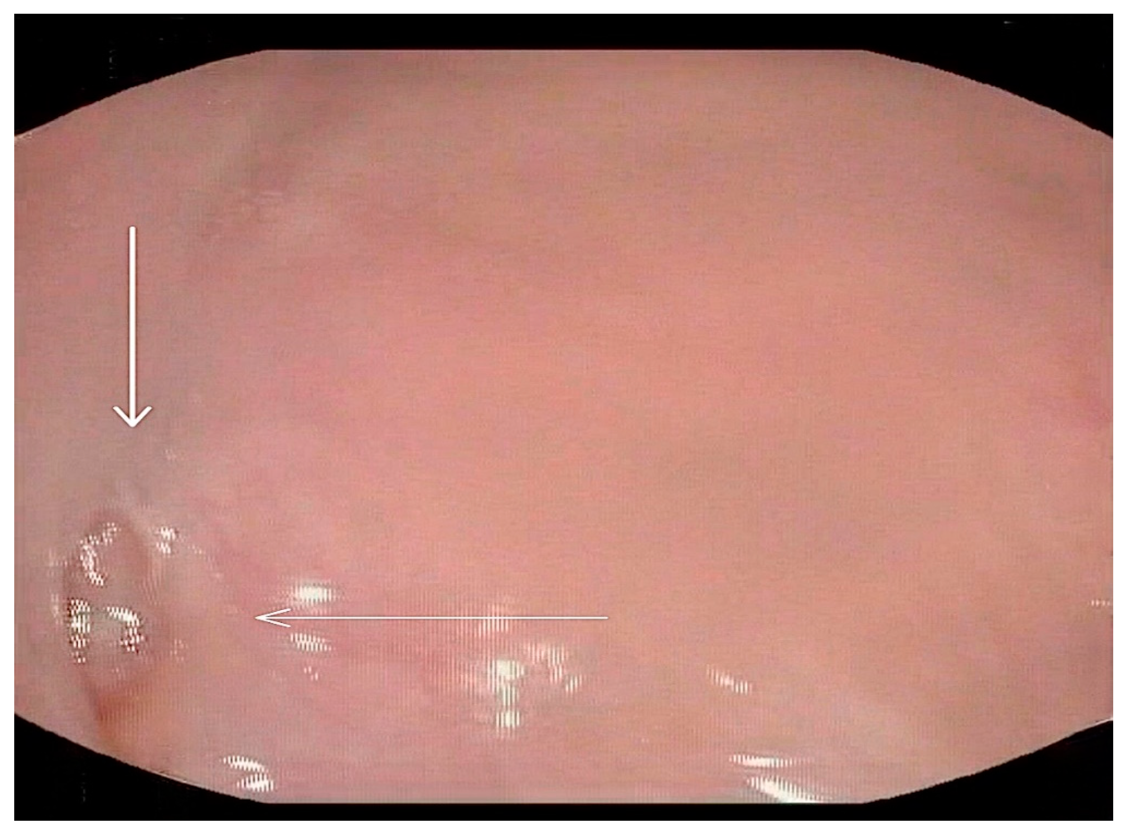 Medicina 60 01628 g006