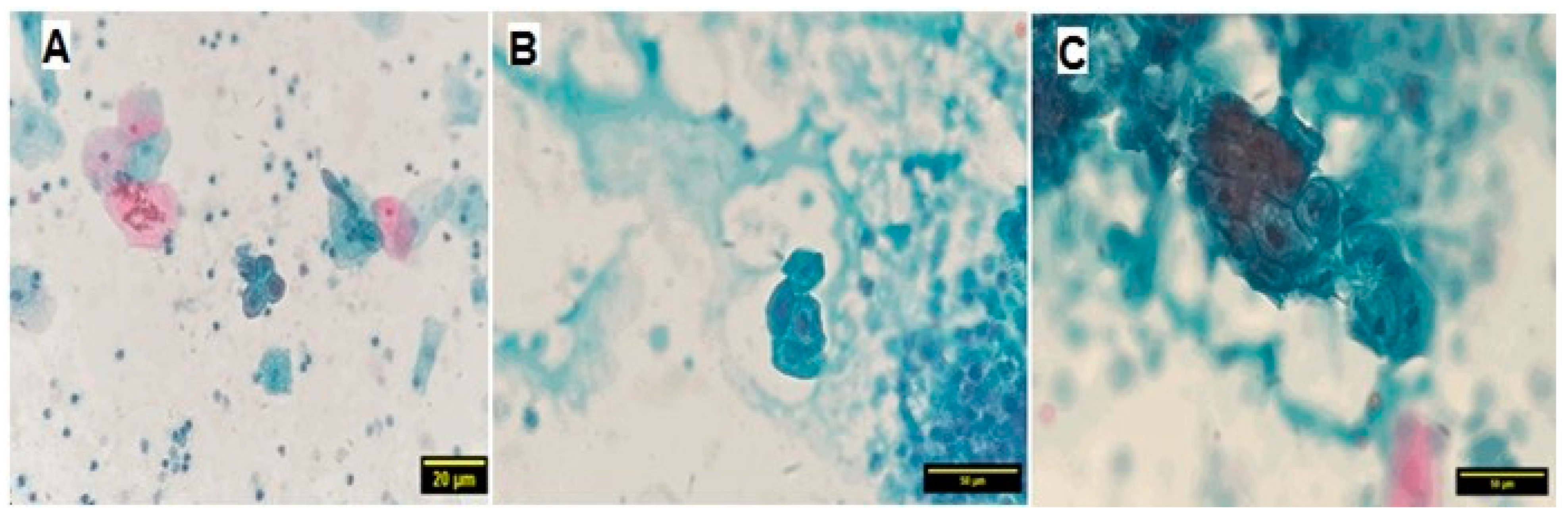 Medicina 60 01630 g002