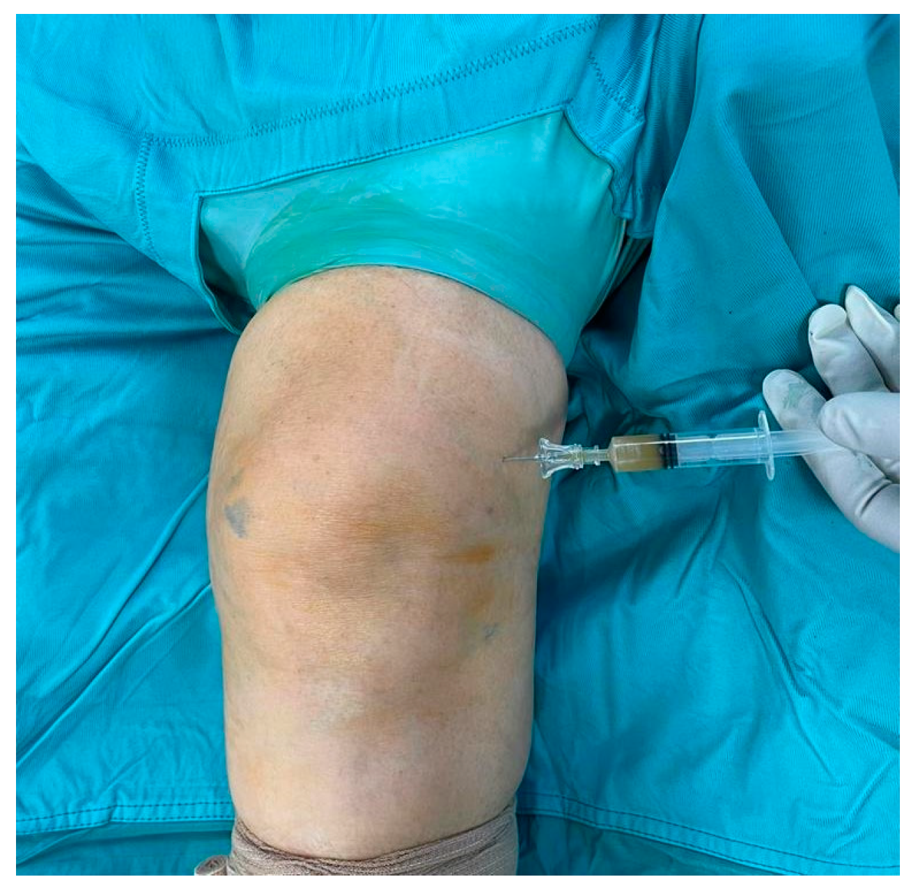 Medicina 60 01636 g001