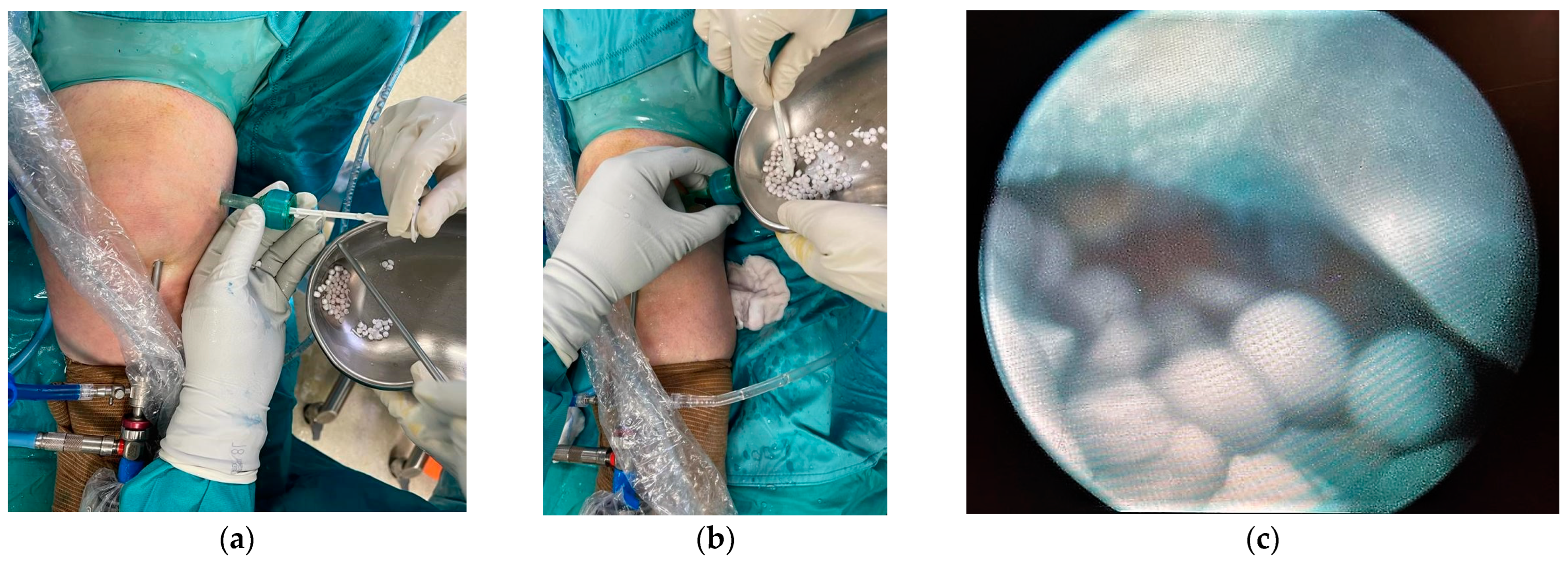 Medicina 60 01636 g004