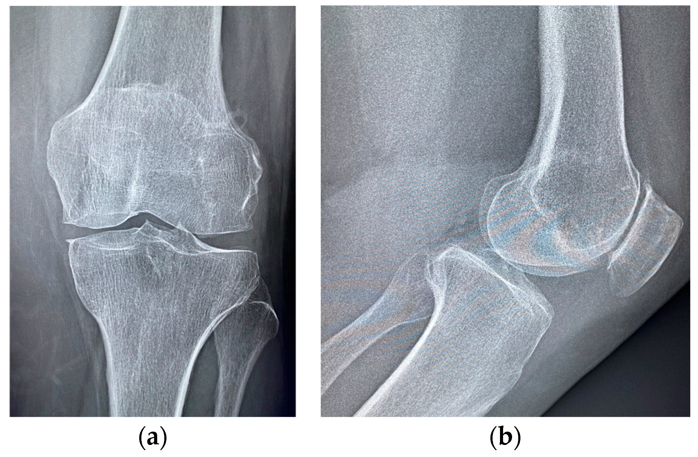 Medicina 60 01636 g007