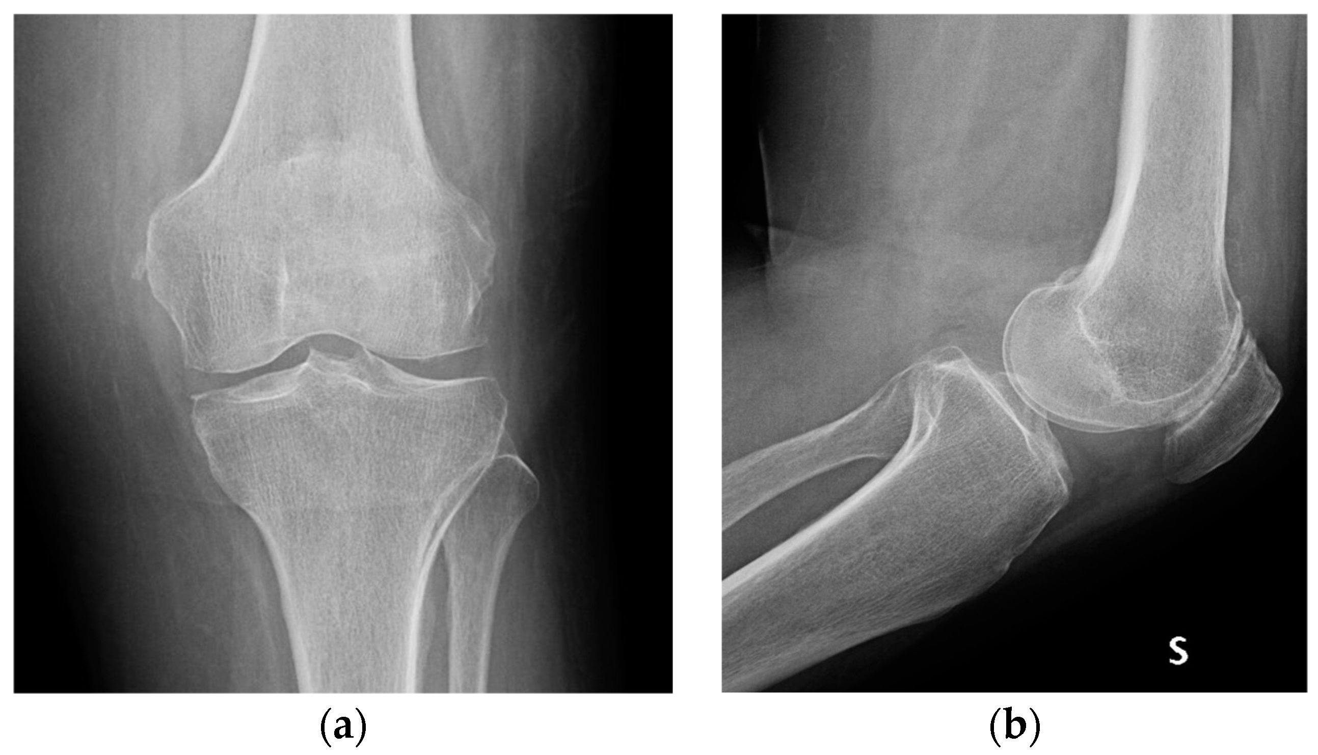 Medicina 60 01636 g008