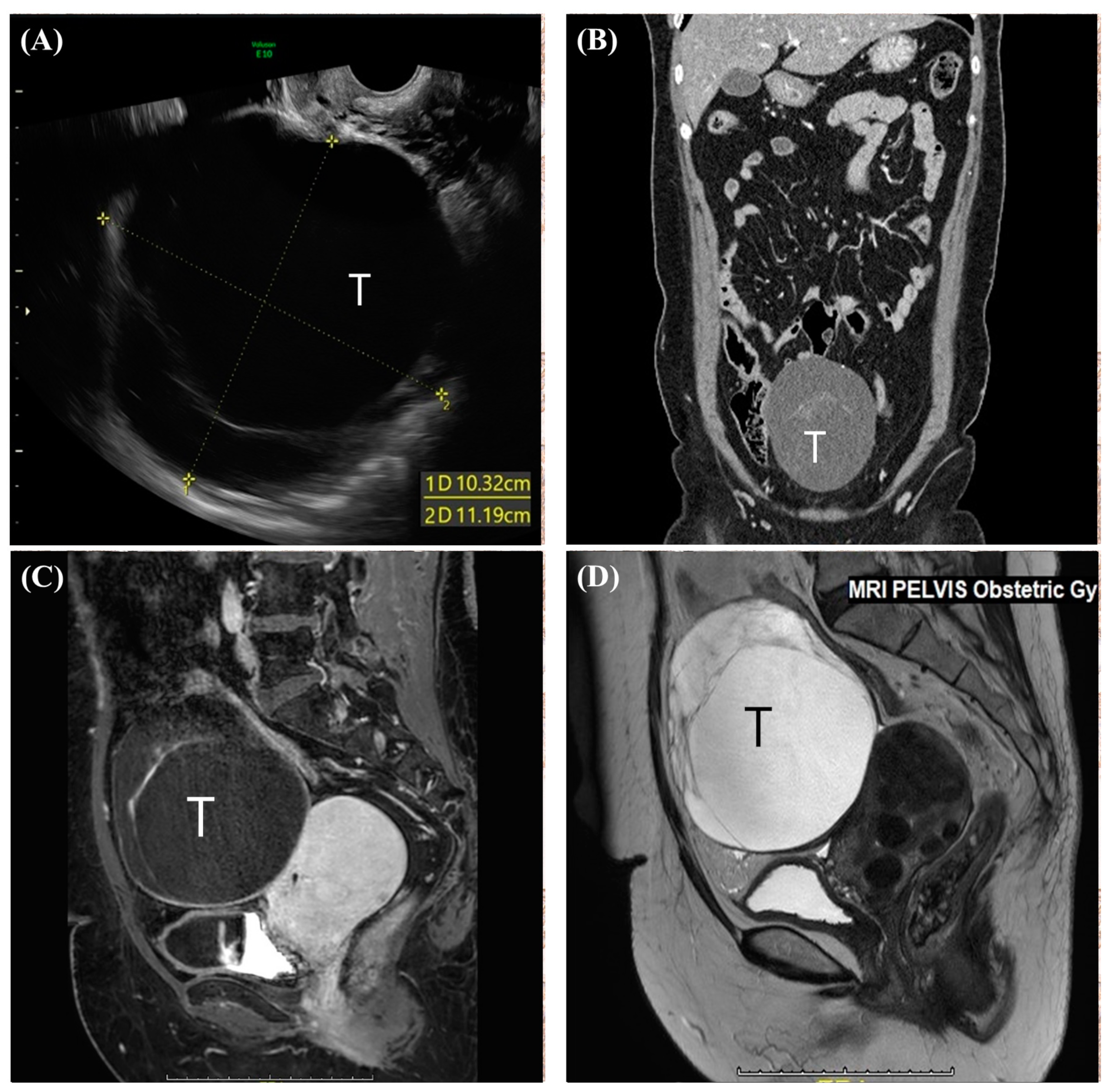 Medicina 60 01645 g001 Medicina 60 01645 g001