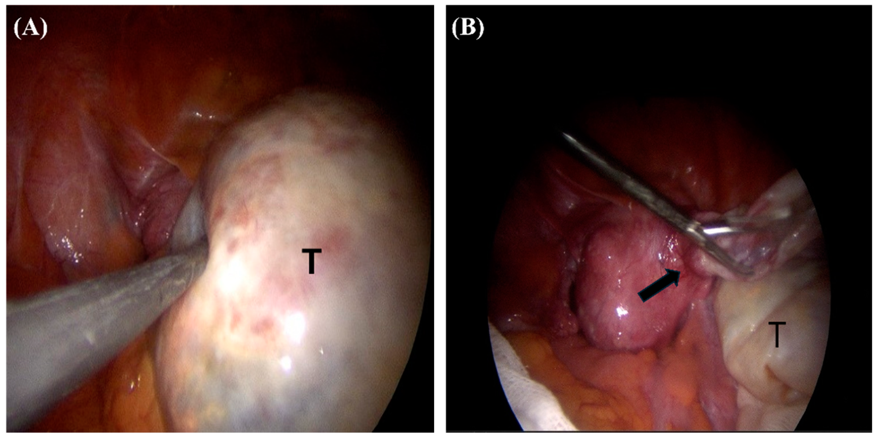 Medicina 60 01645 g002 Medicina 60 01645 g002