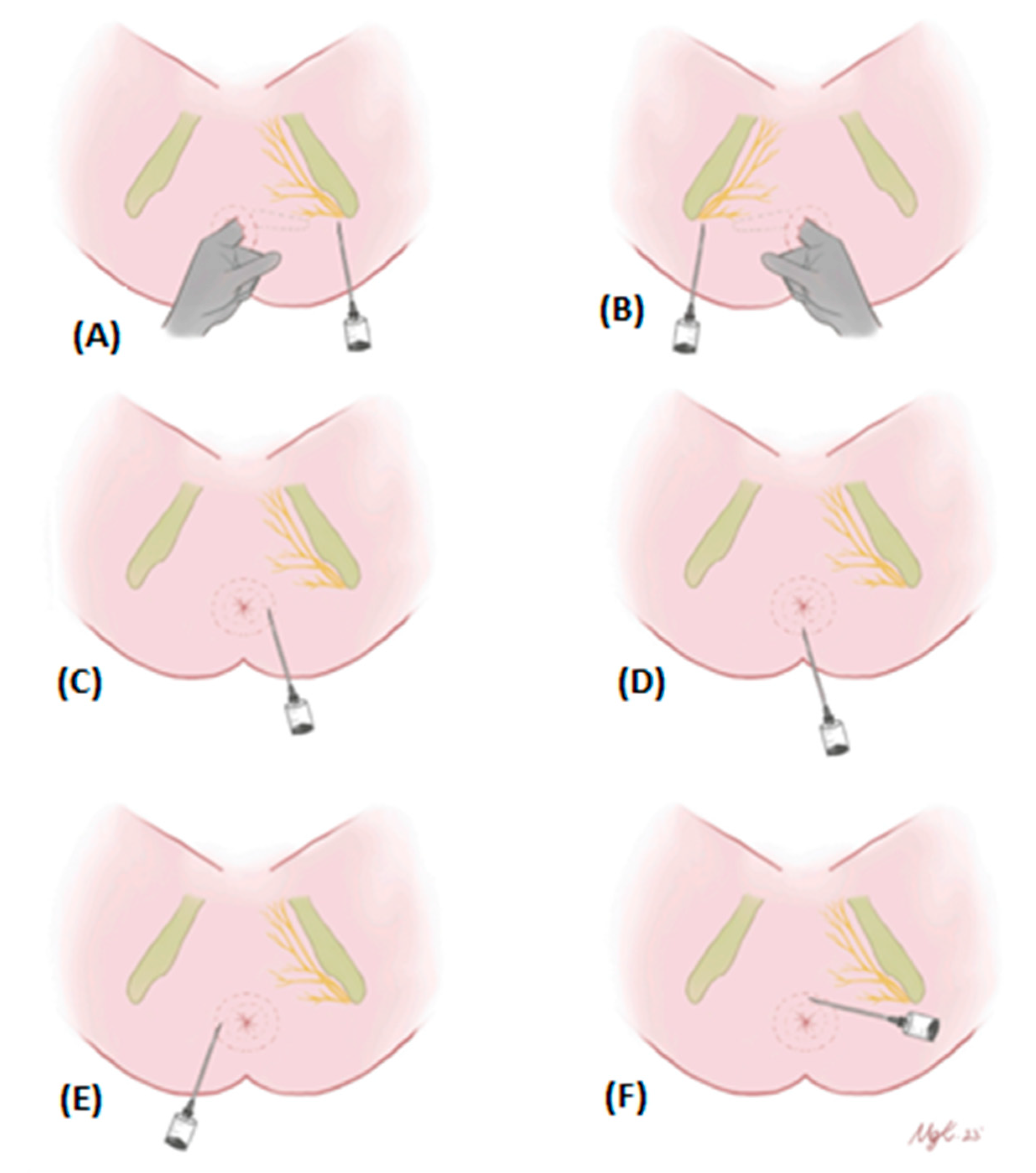 Medicina 60 01651 g001