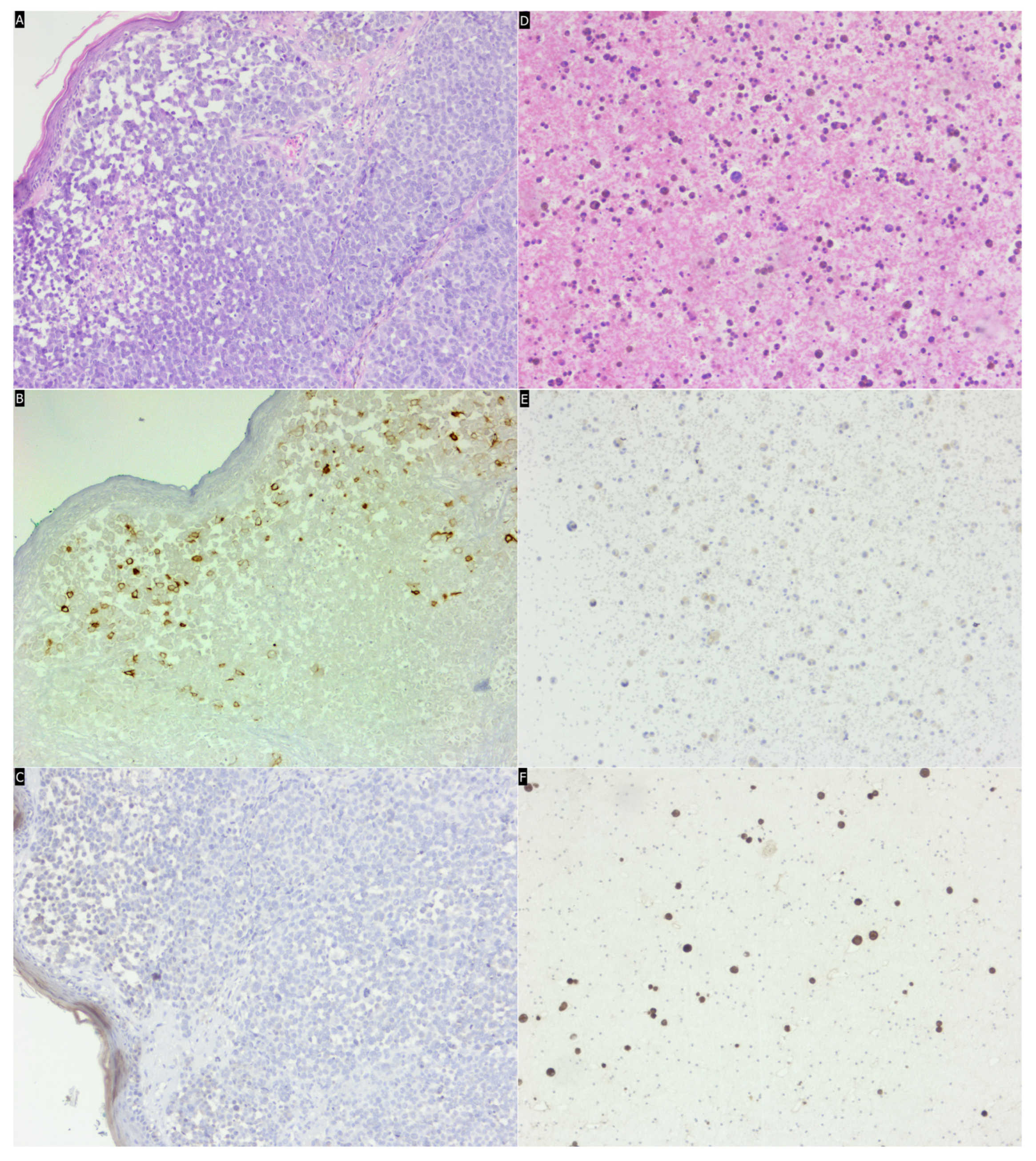 Medicina 60 01658 g001