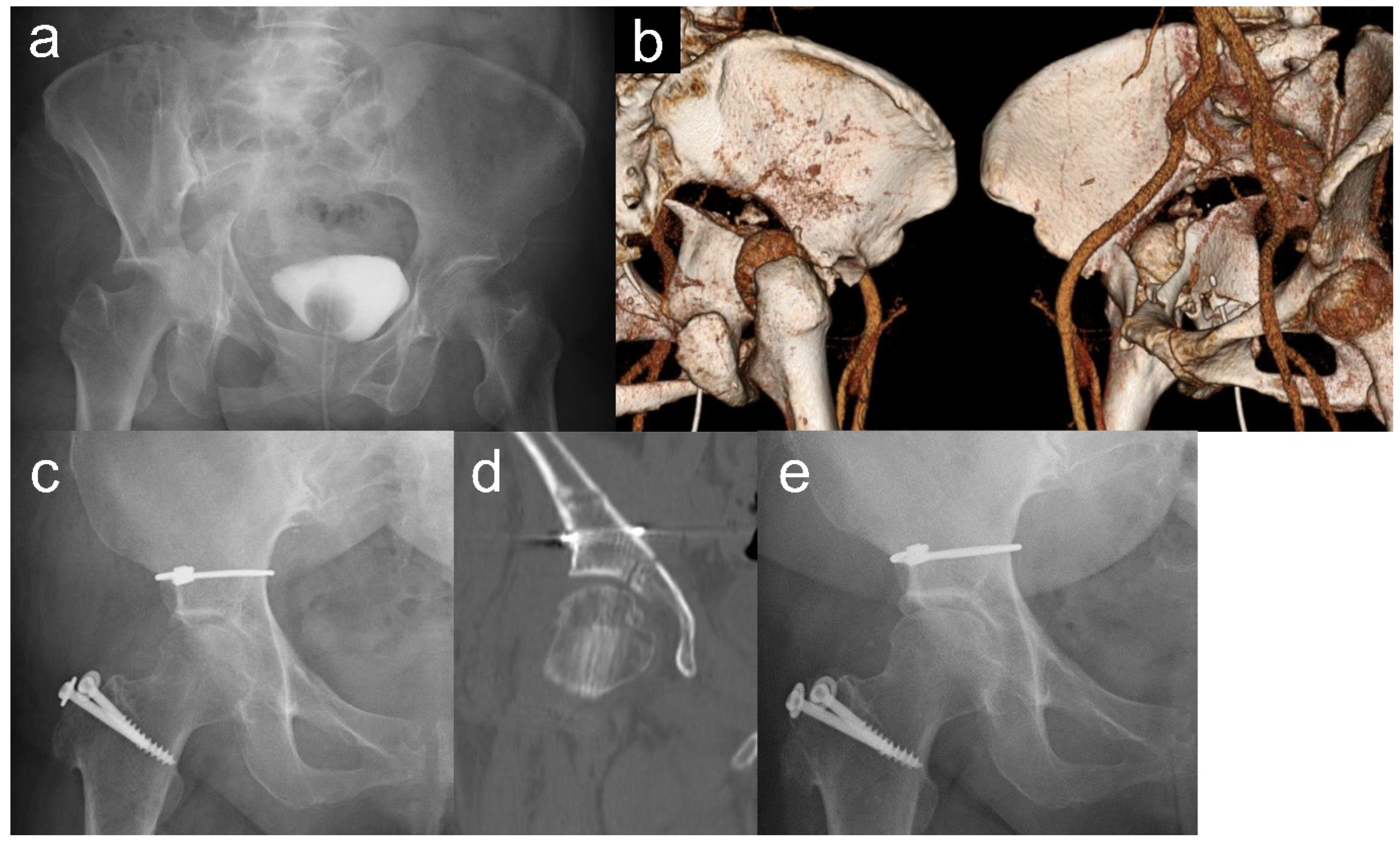 Medicina 60 01659 g001