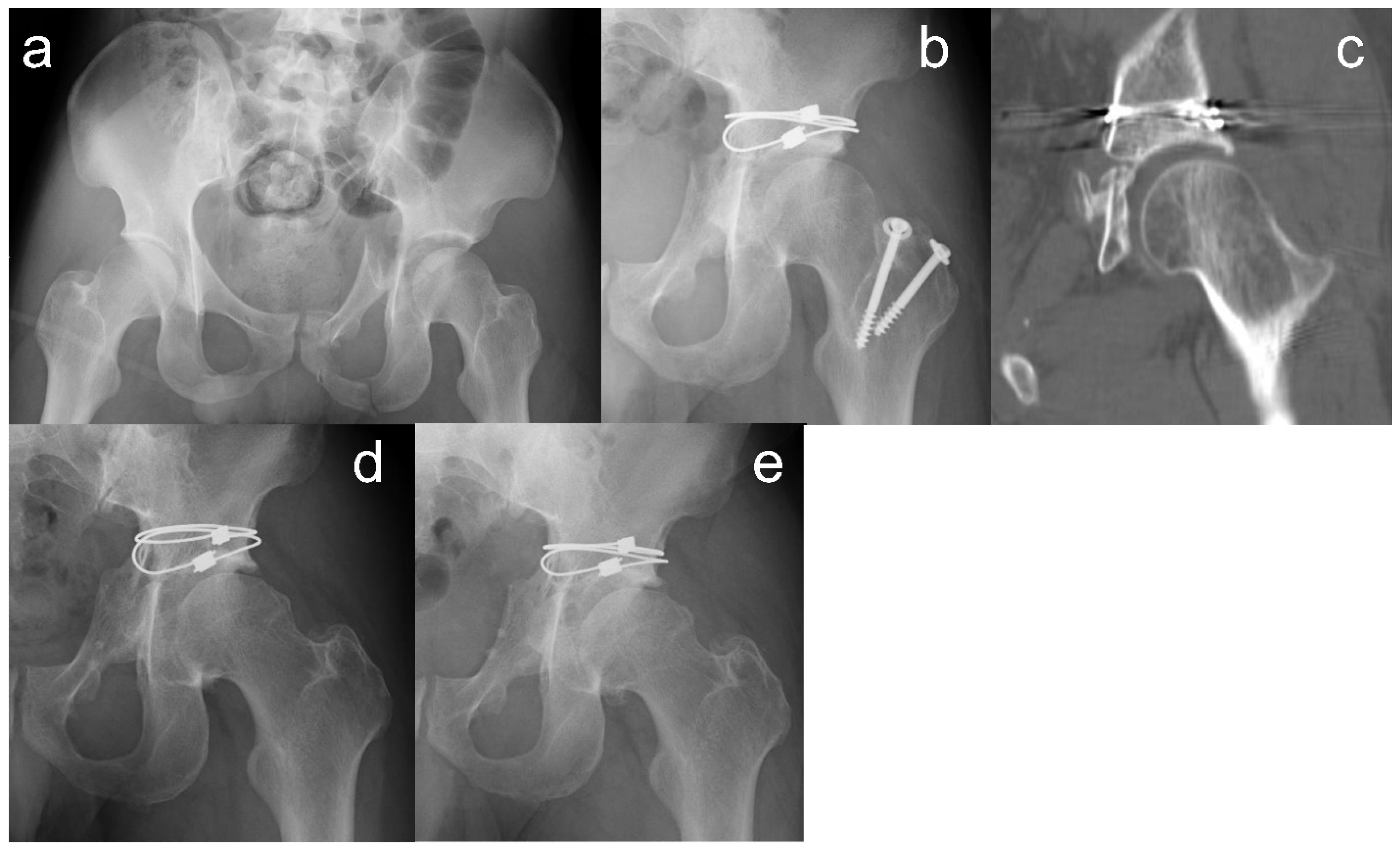 Medicina 60 01659 g002