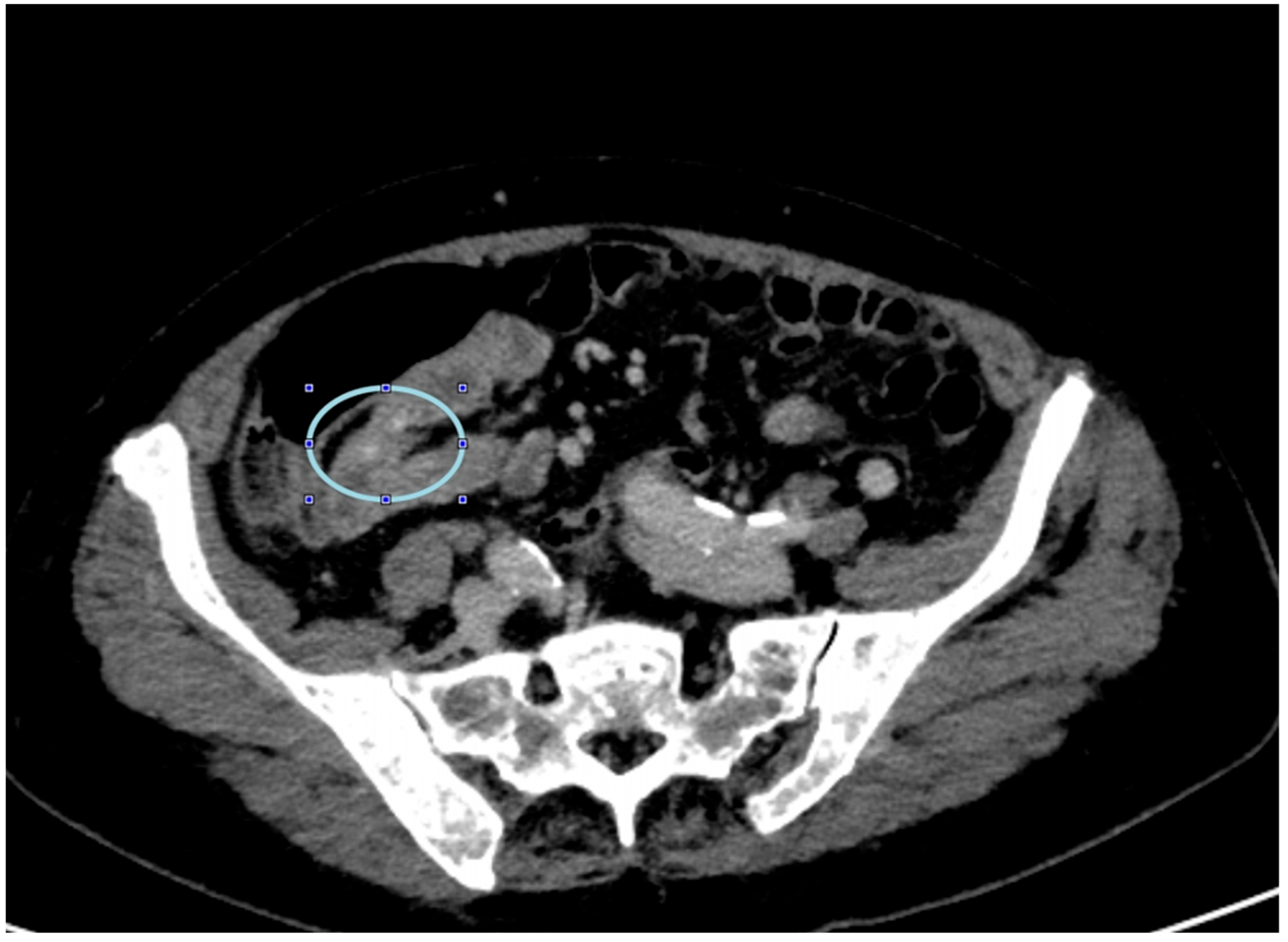 Medicina 60 01664 g001