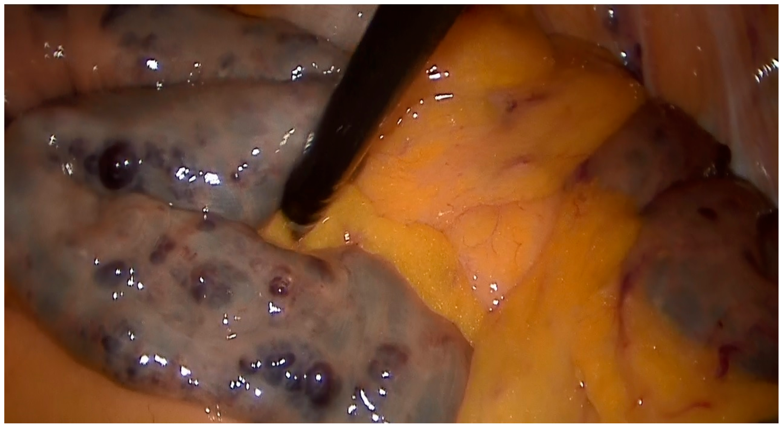 Medicina 60 01664 g003