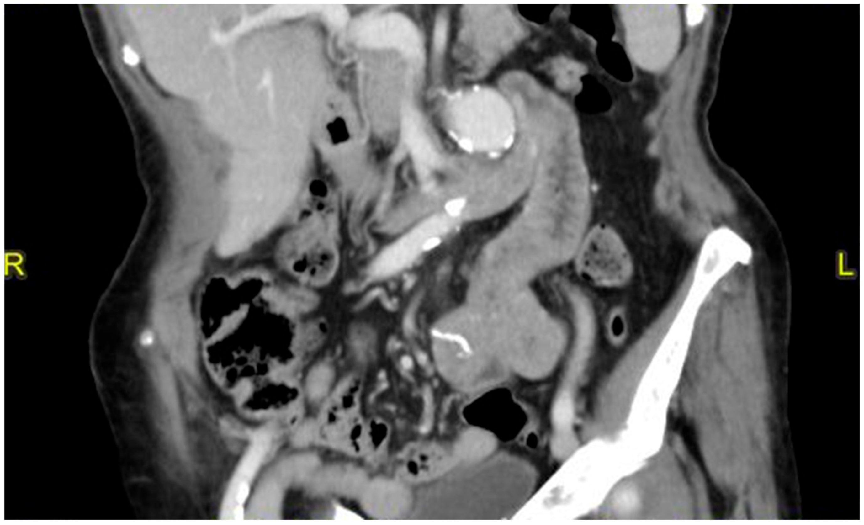 Medicina 60 01664 g004b