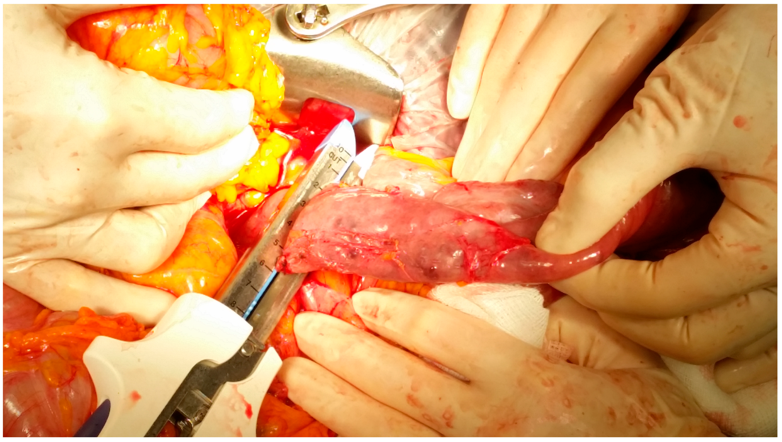 Medicina 60 01664 g006