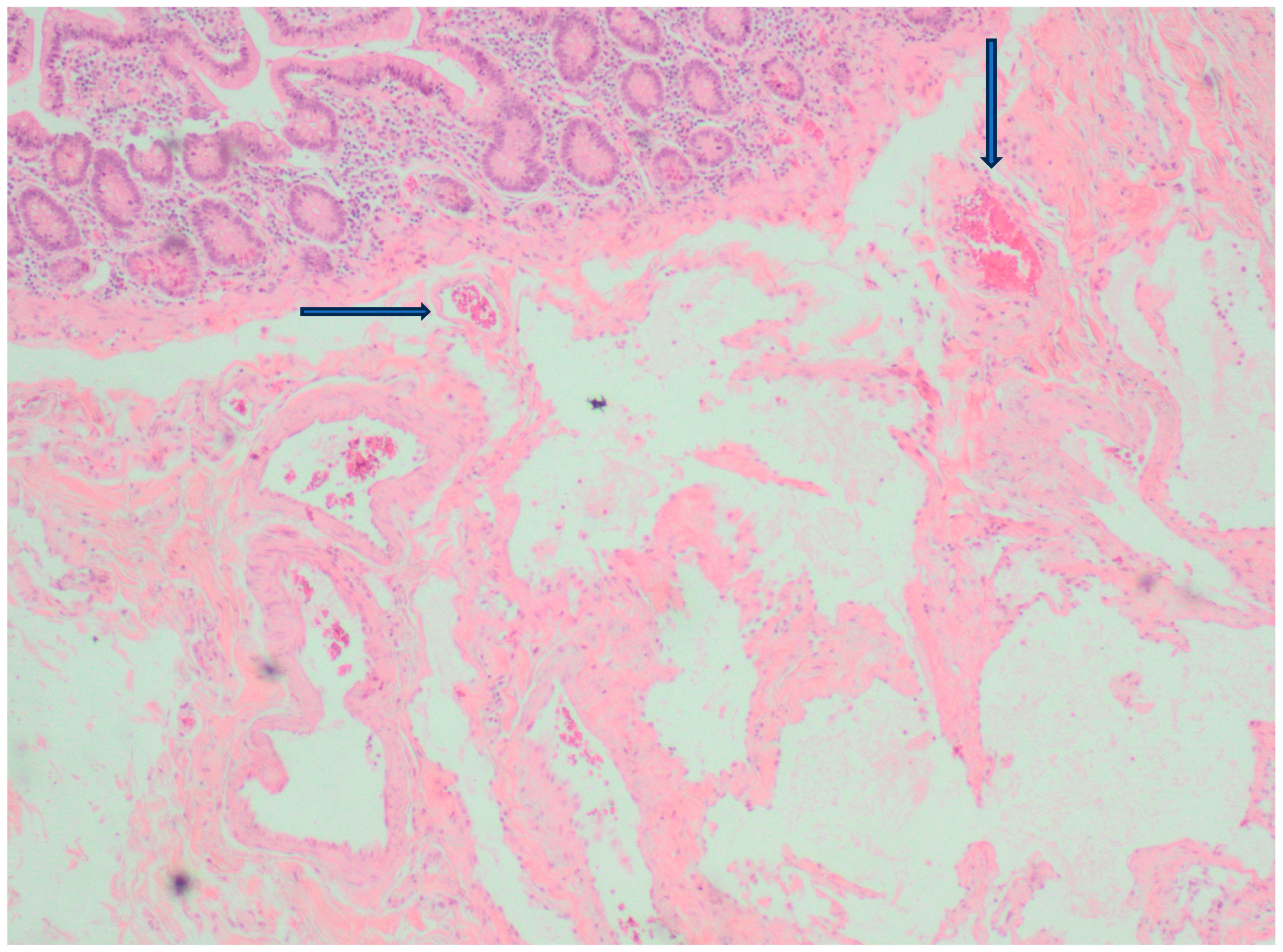 Medicina 60 01664 g007