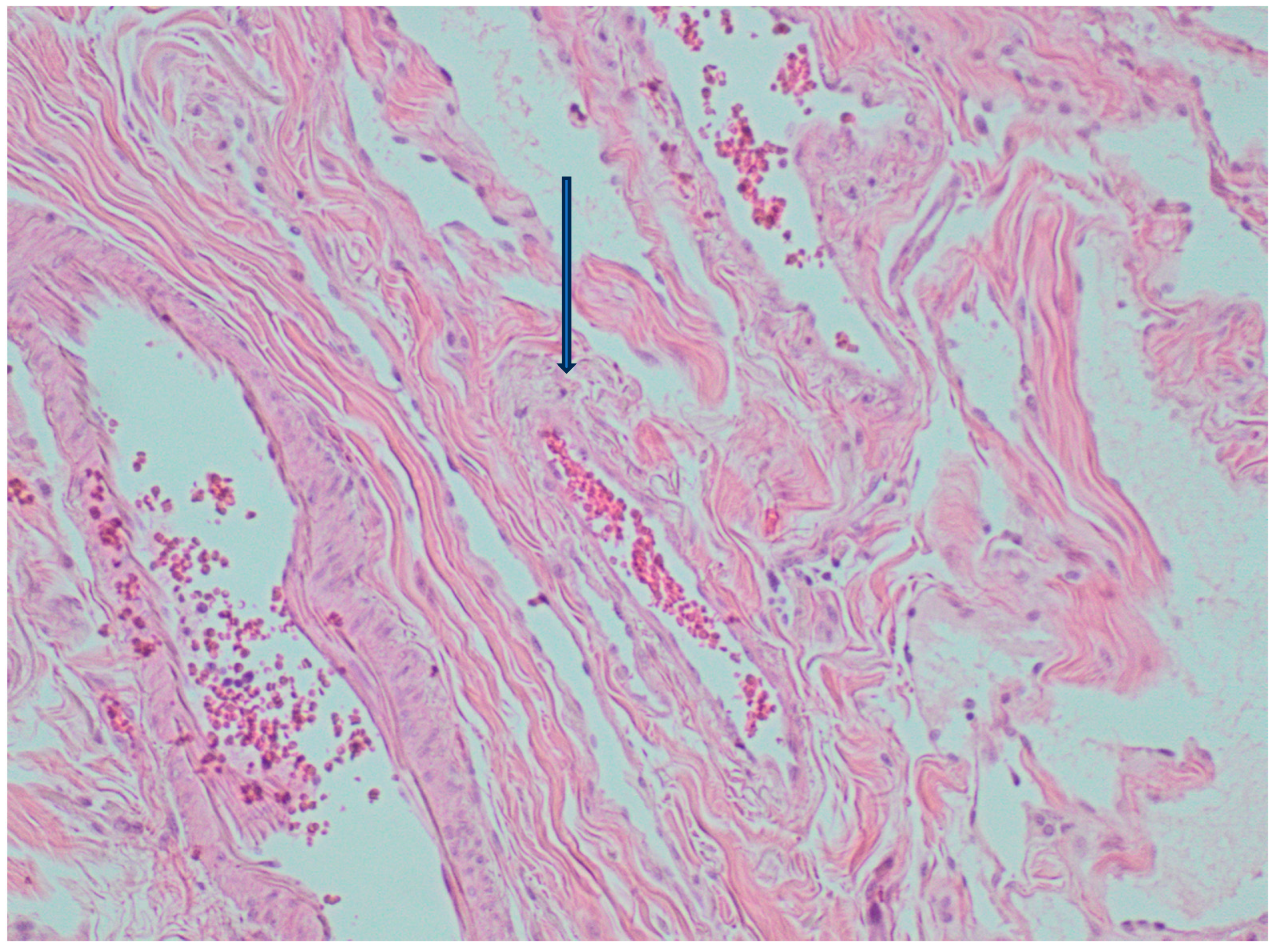 Medicina 60 01664 g008