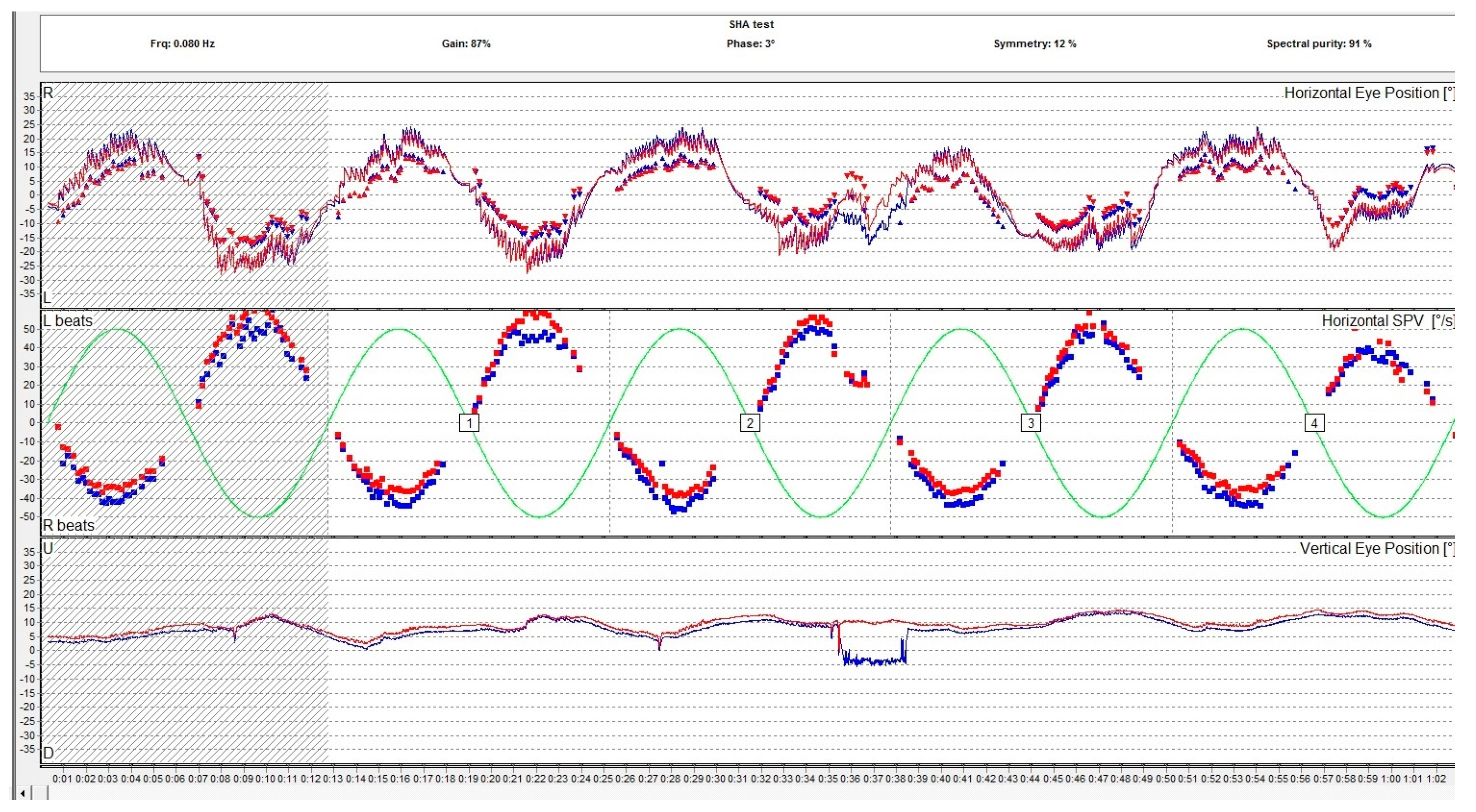 Medicina 60 01665 g004