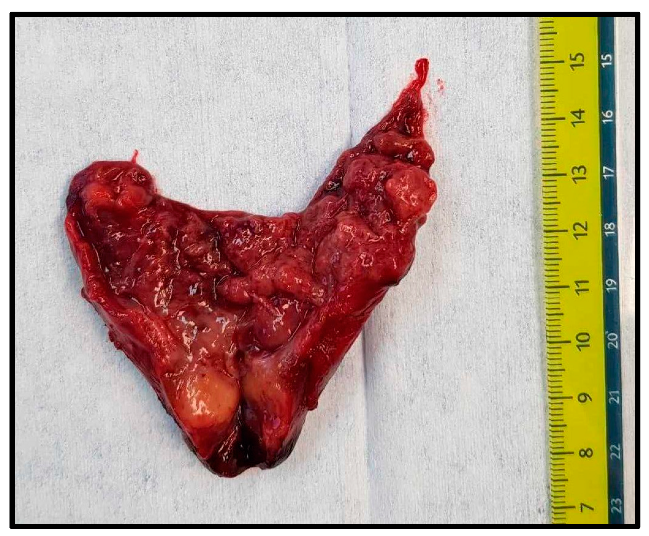 Medicina 60 01666 g002