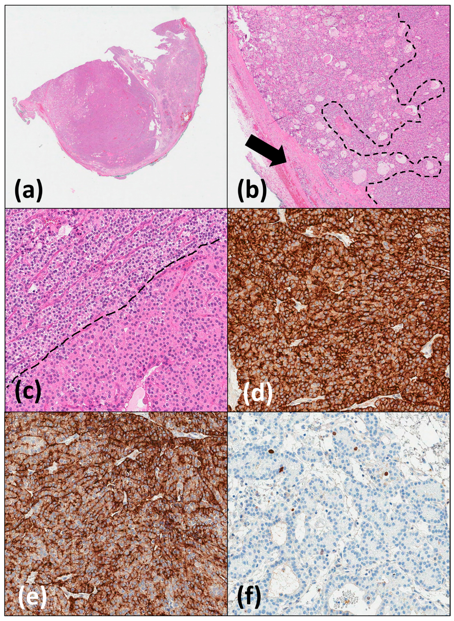 Medicina 60 01666 g003