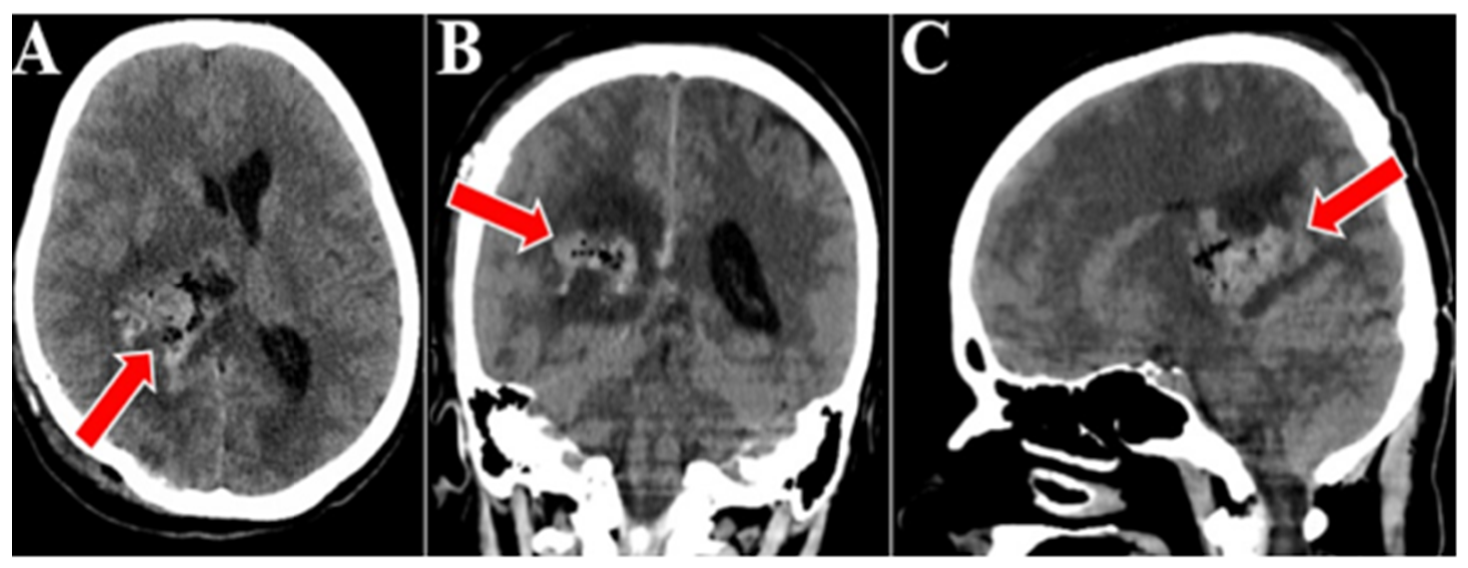 Medicina 60 01667 g004
