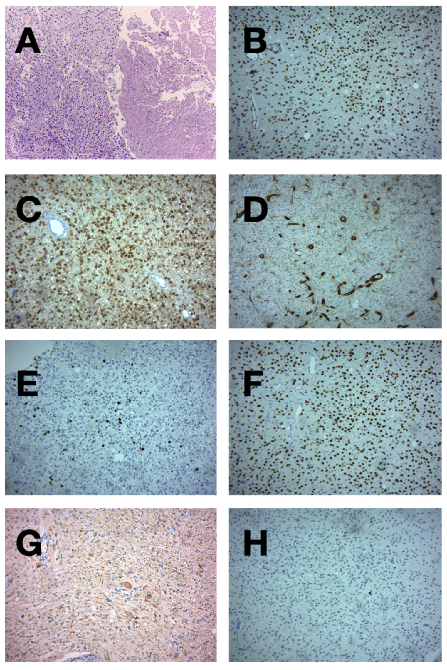 Medicina 60 01667 g005
