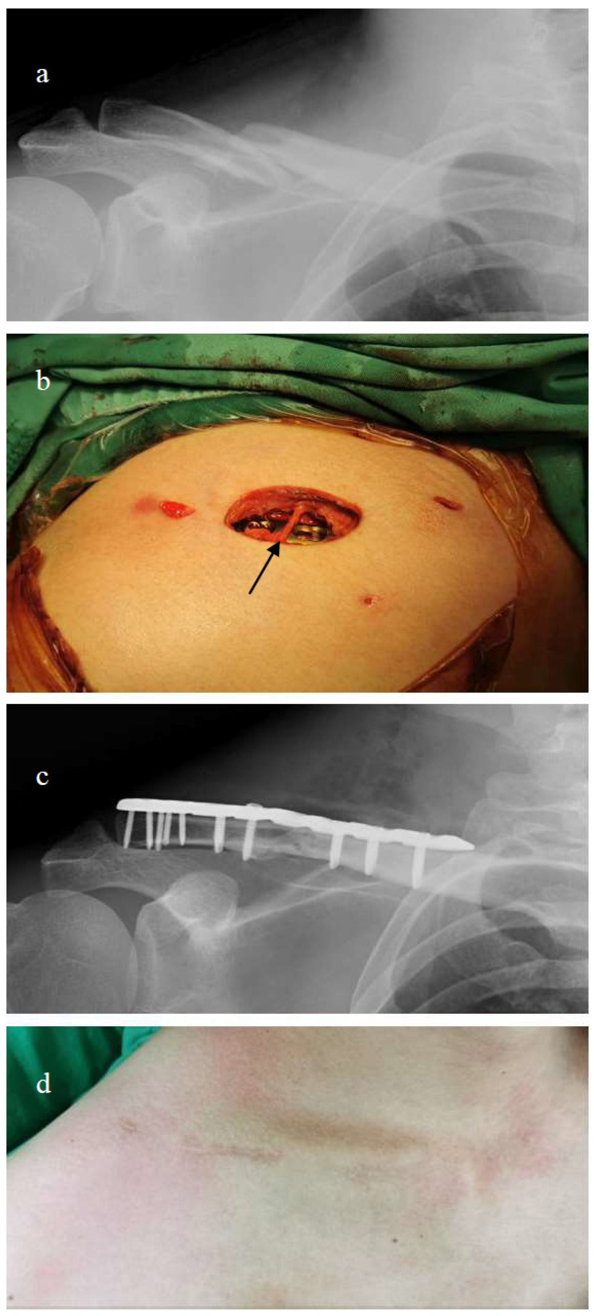 Medicina 60 01669 g002