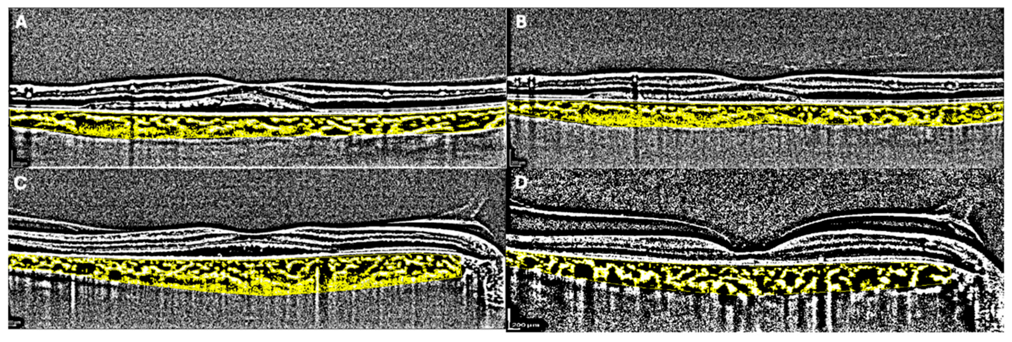 Medicina 60 01674 g002
