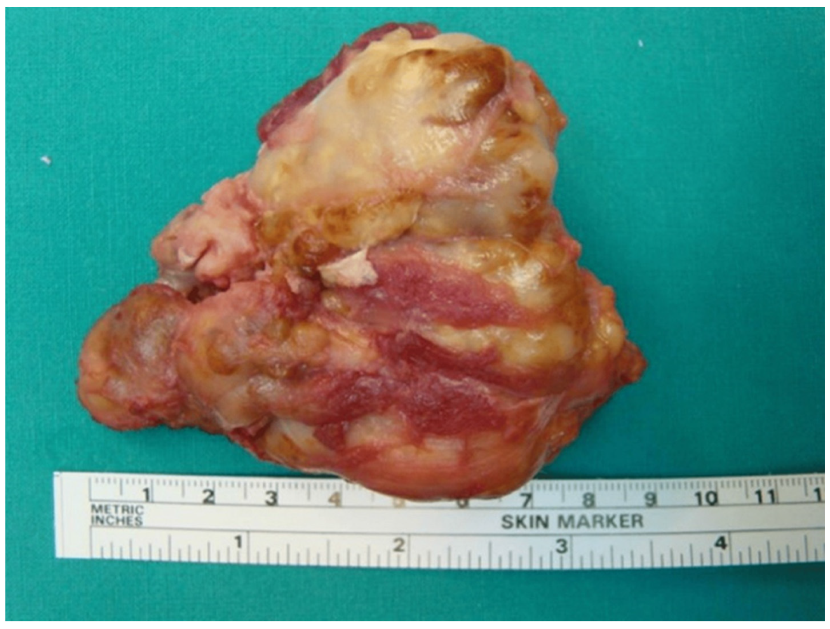 Medicina 60 01675 g004 Medicina 60 01675 g004