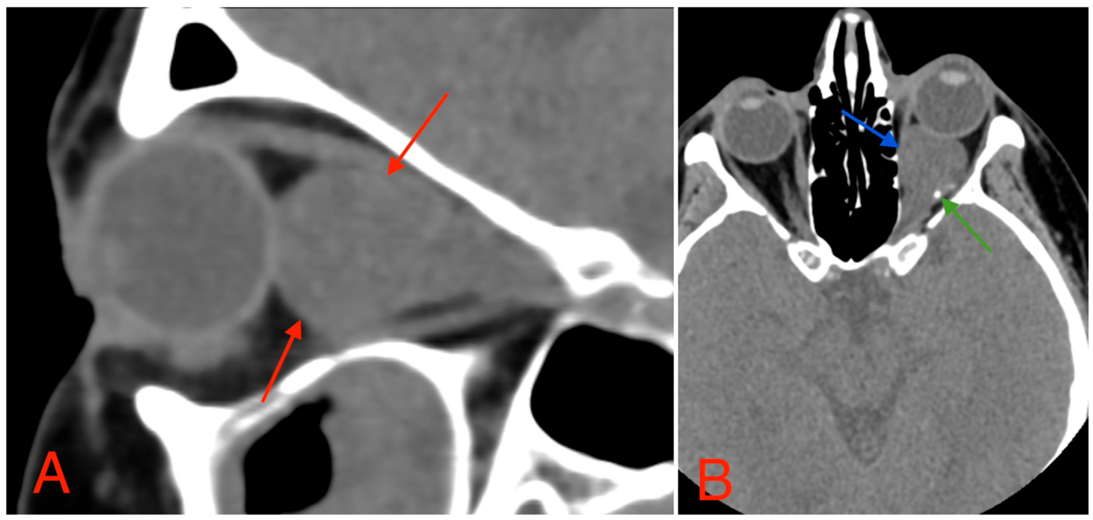Medicina 60 01687 g003