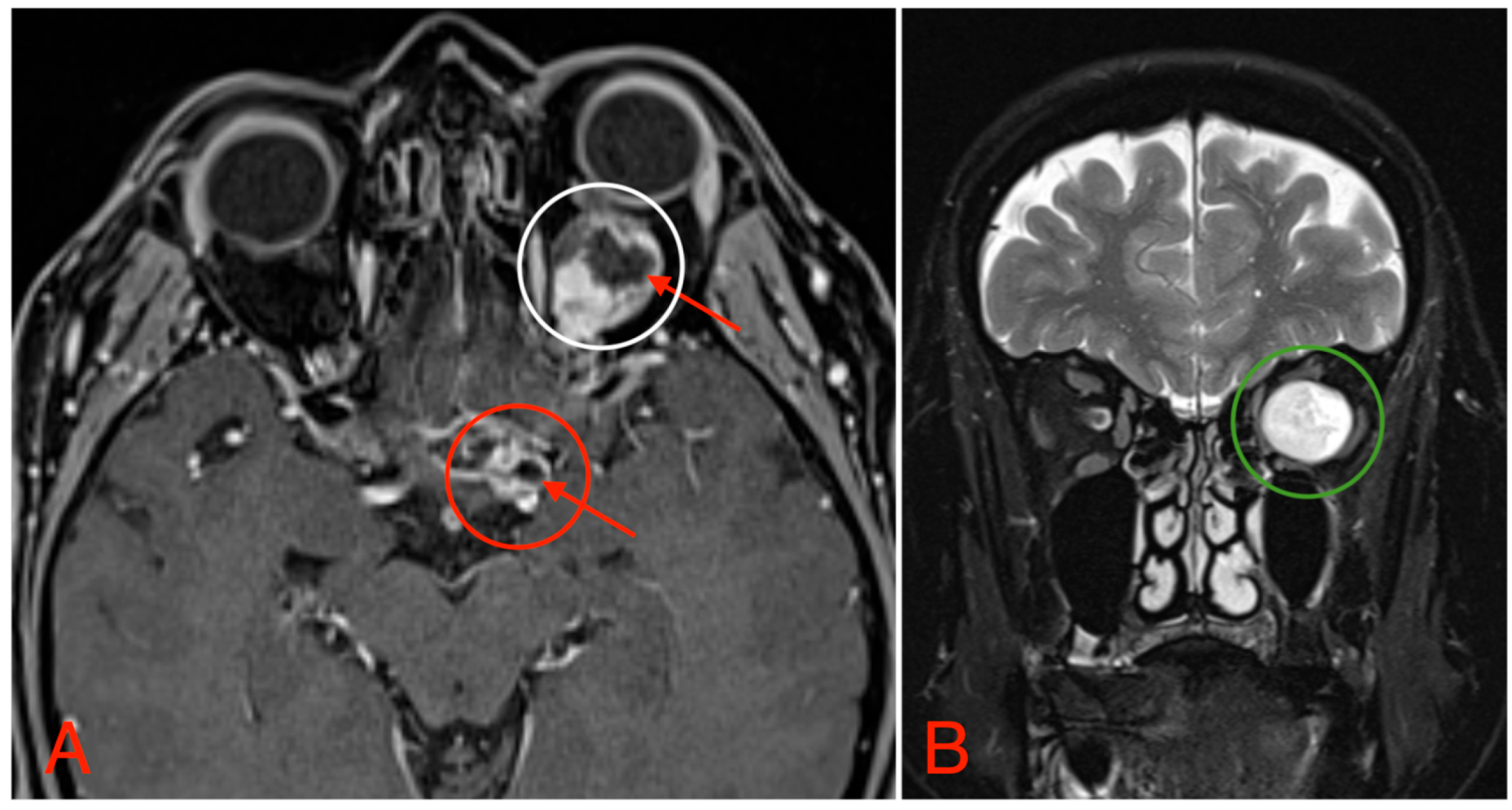 Medicina 60 01687 g004