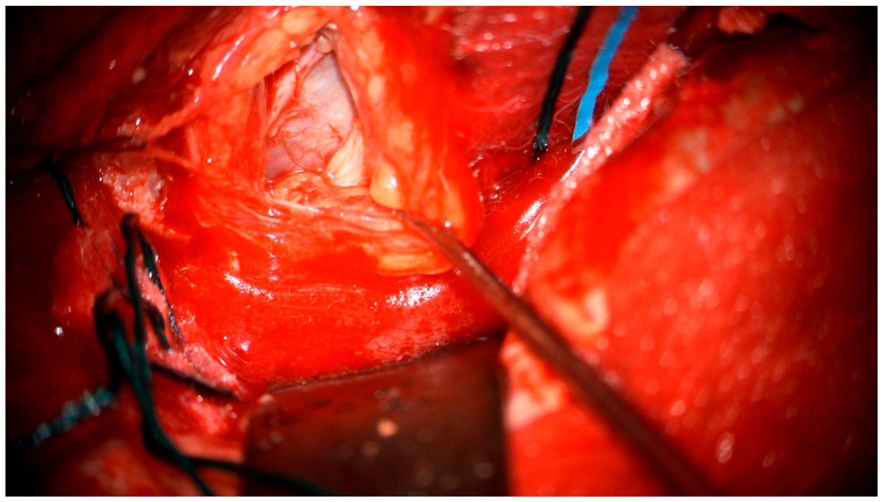 Medicina 60 01687 g005