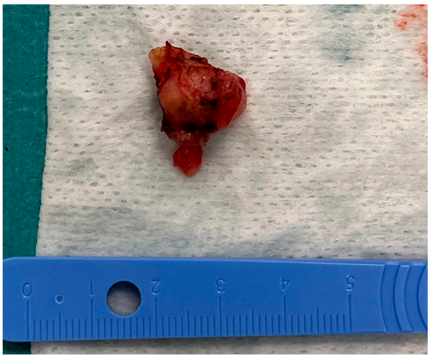 Medicina 60 01687 g006