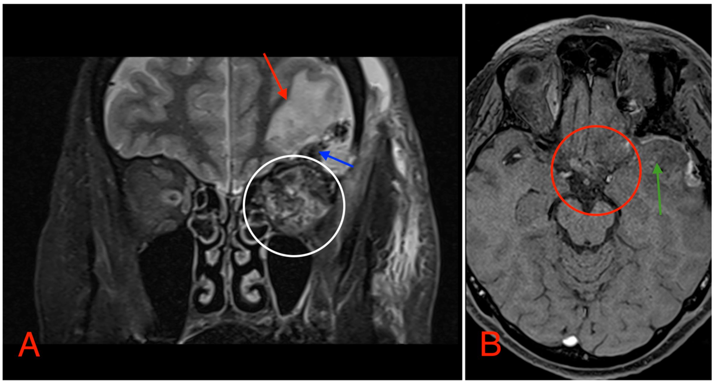 Medicina 60 01687 g008