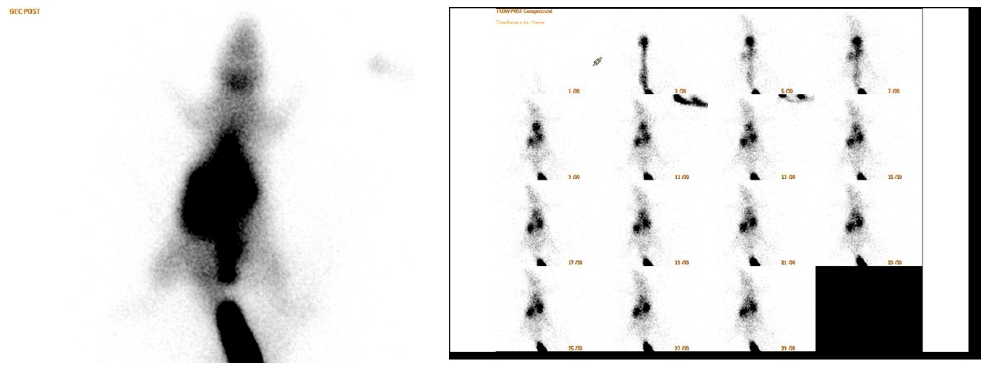 Medicina 60 01689 g005