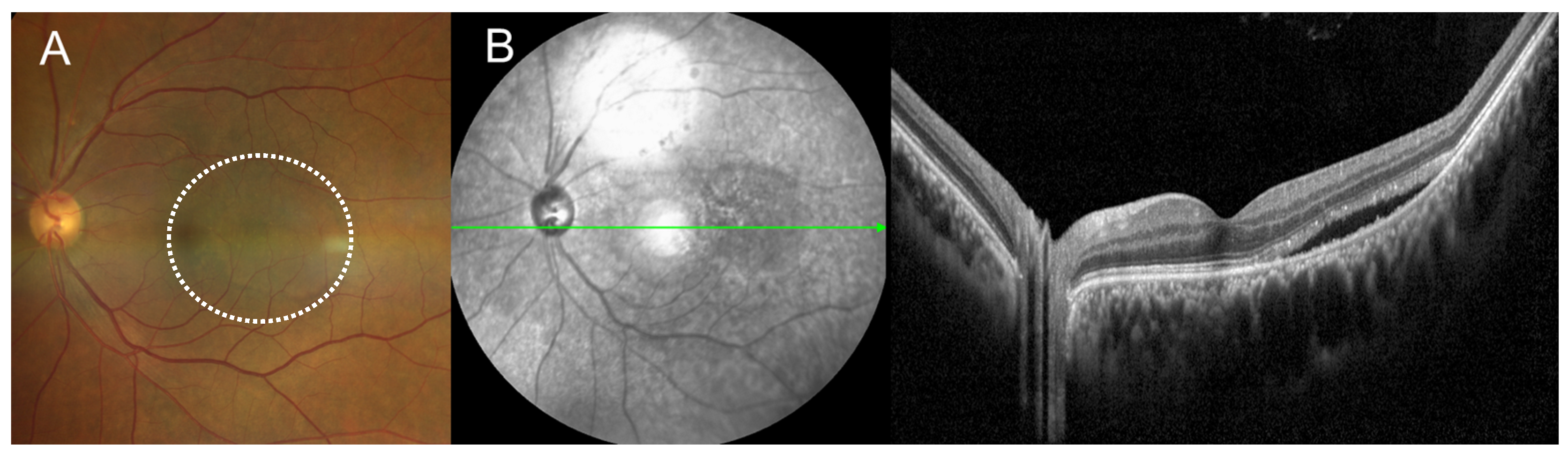 Medicina 60 01690 g001