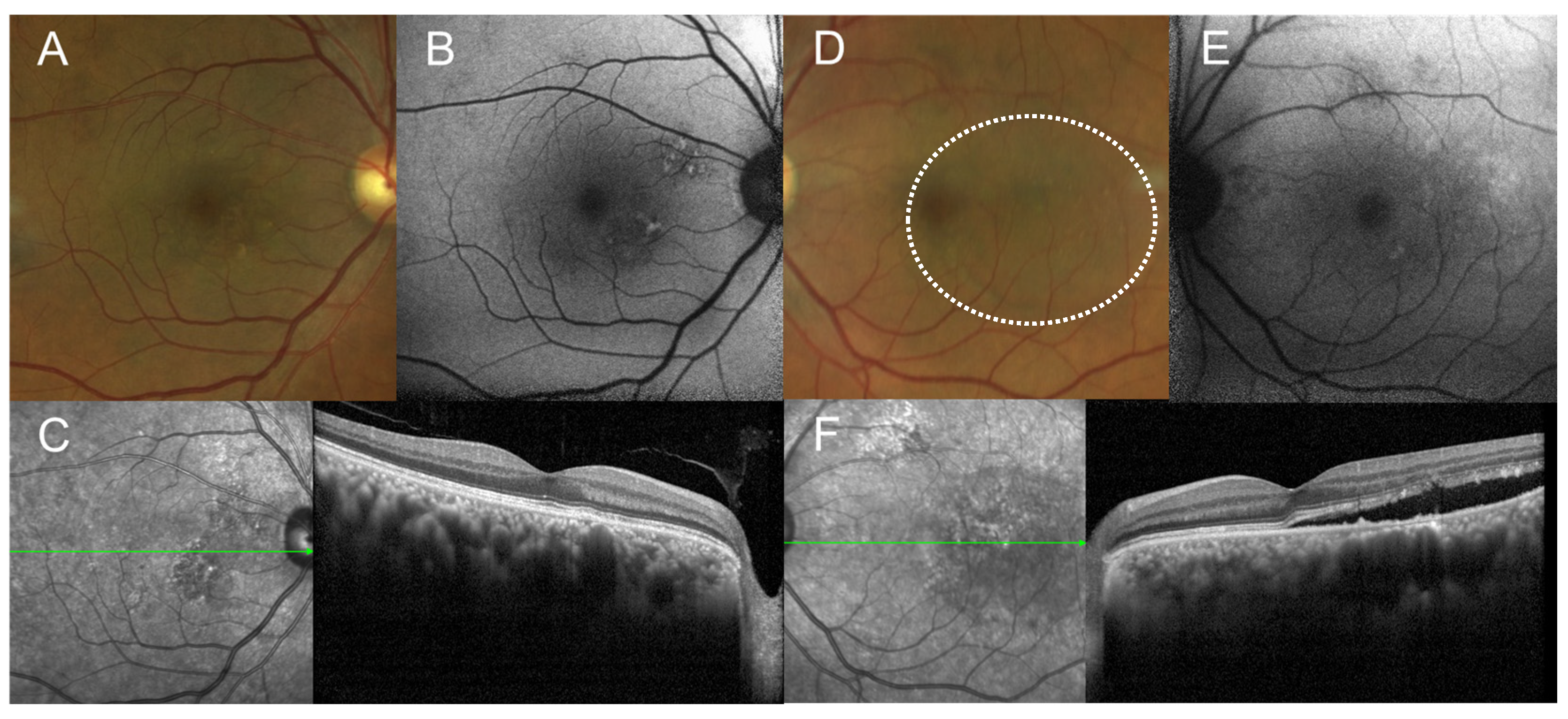 Medicina 60 01690 g002