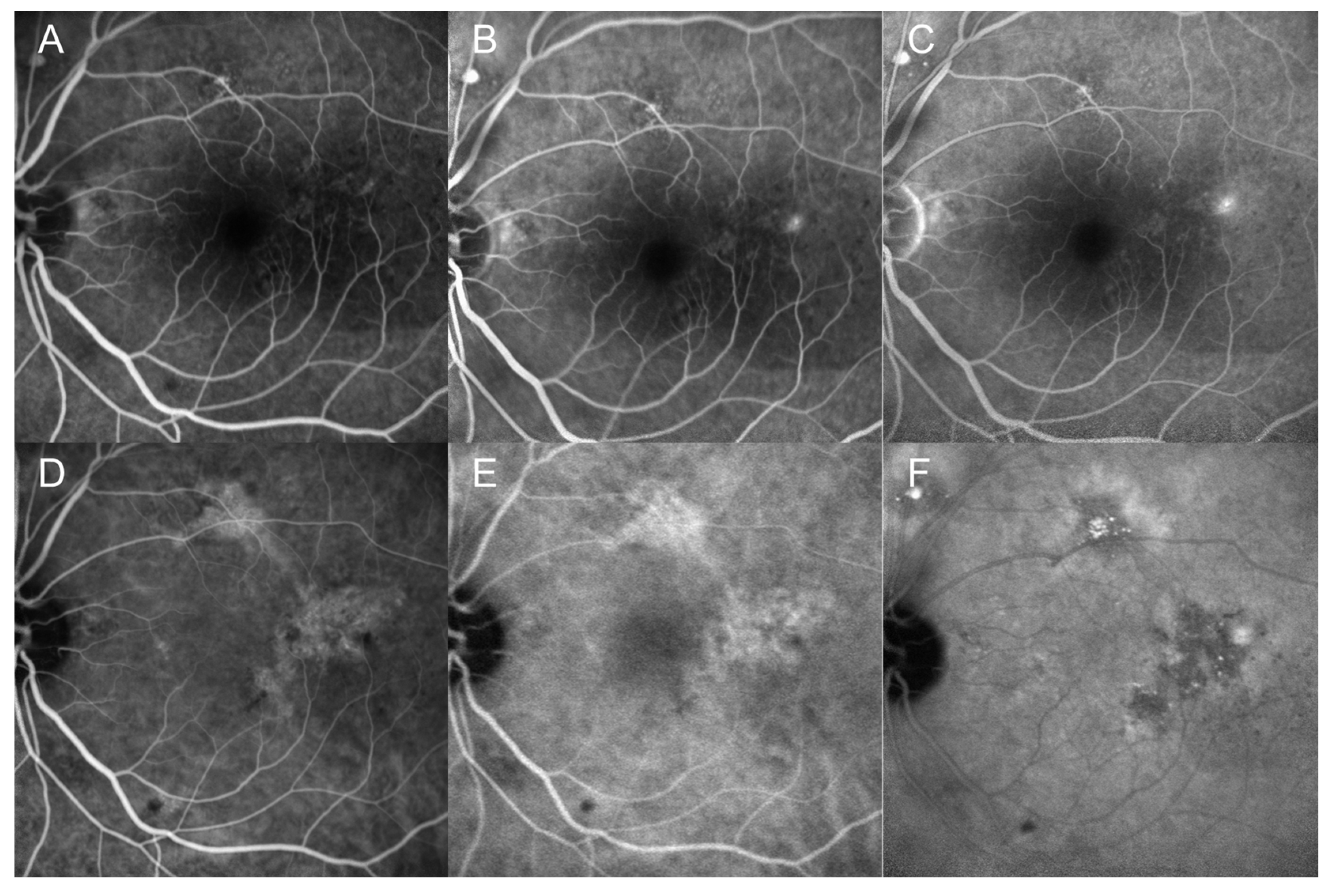 Medicina 60 01690 g003