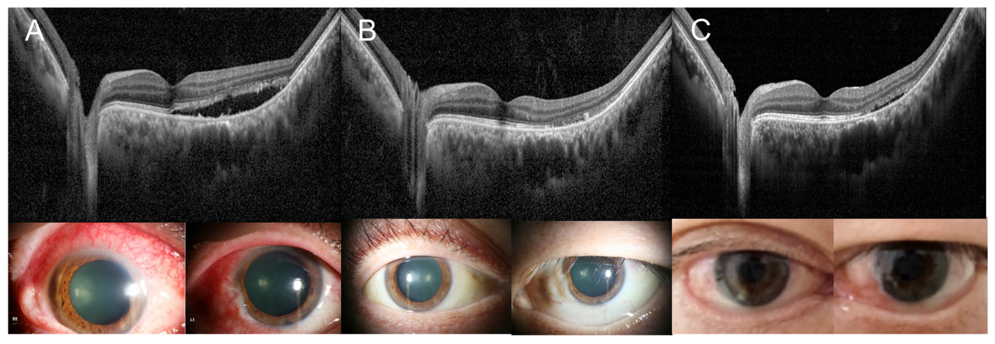 Medicina 60 01690 g004