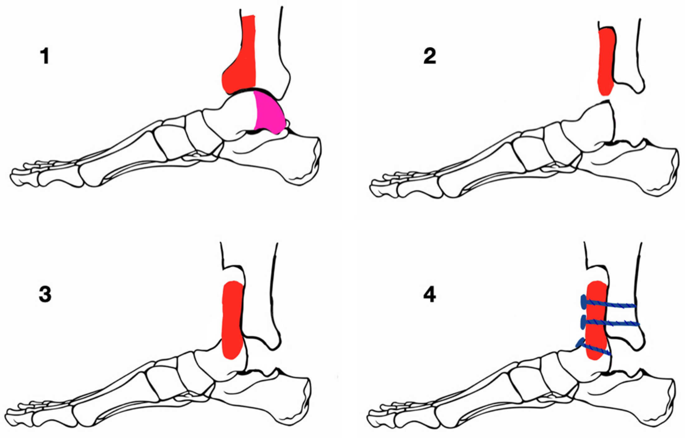 Medicina 60 01692 g003