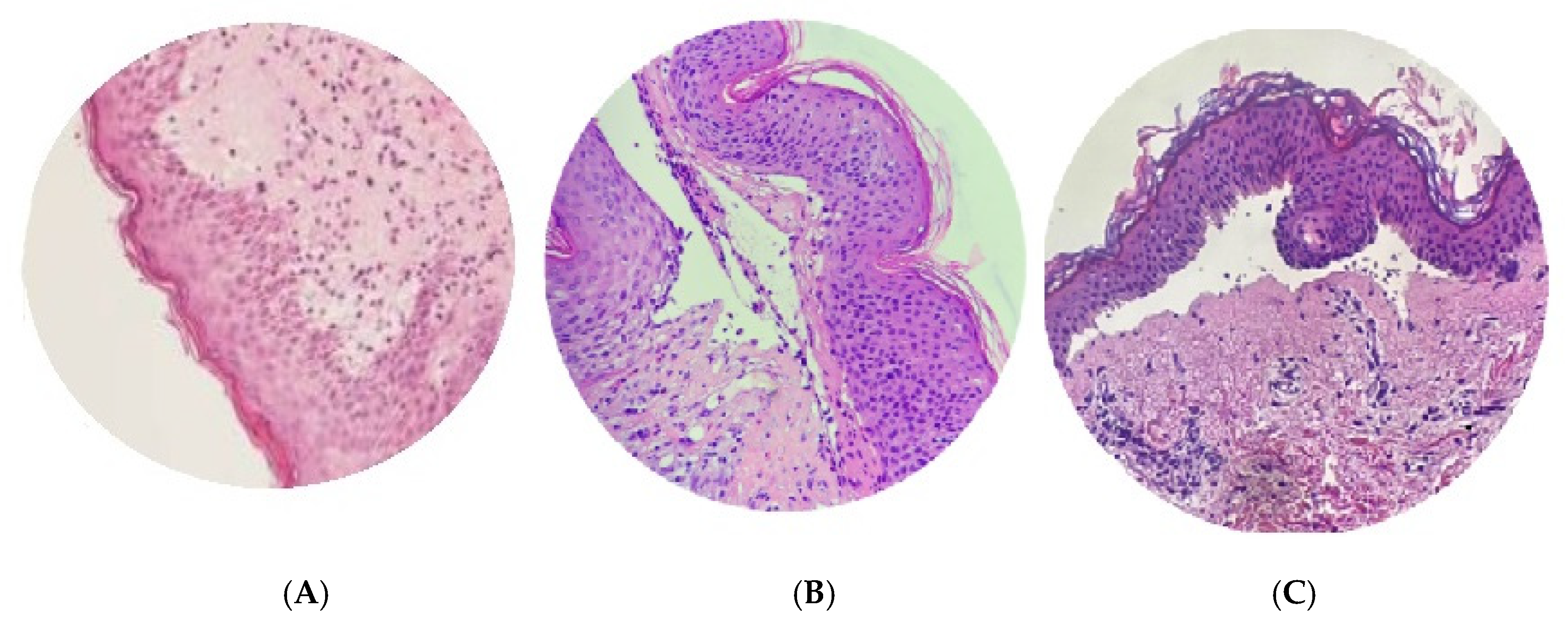 Medicina 60 01701 g003