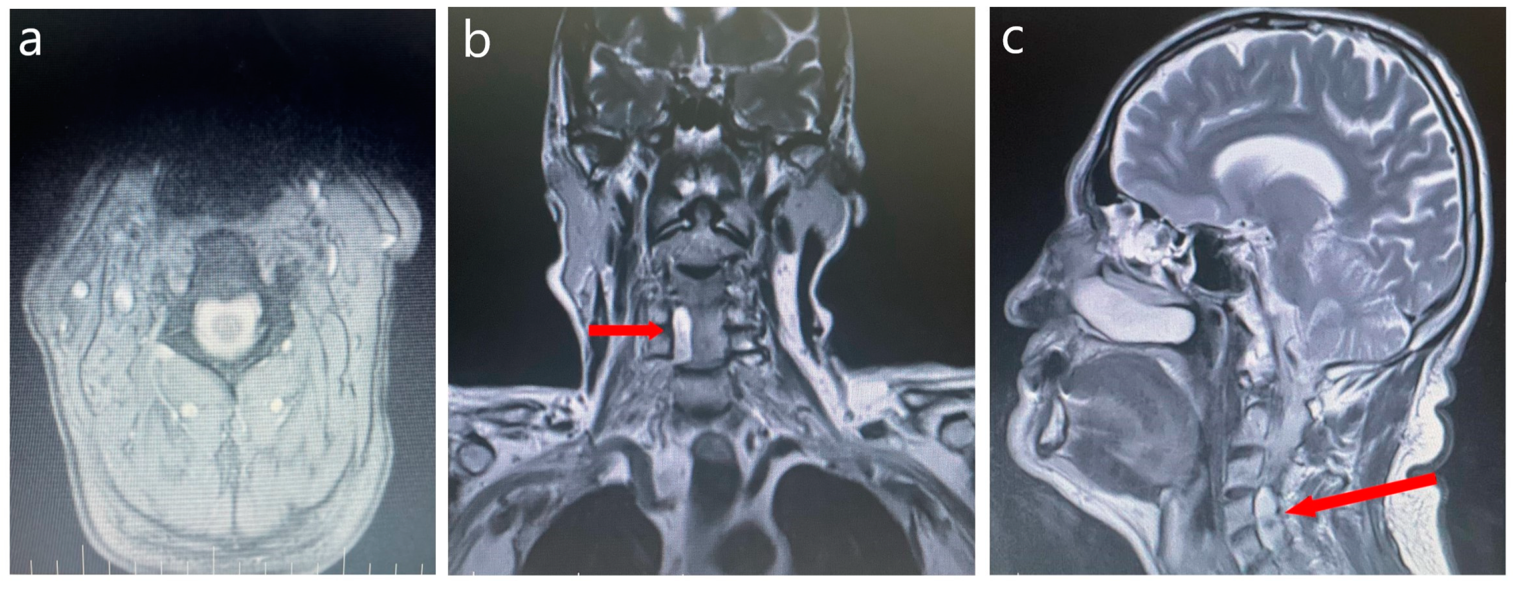Medicina 60 01703 g002