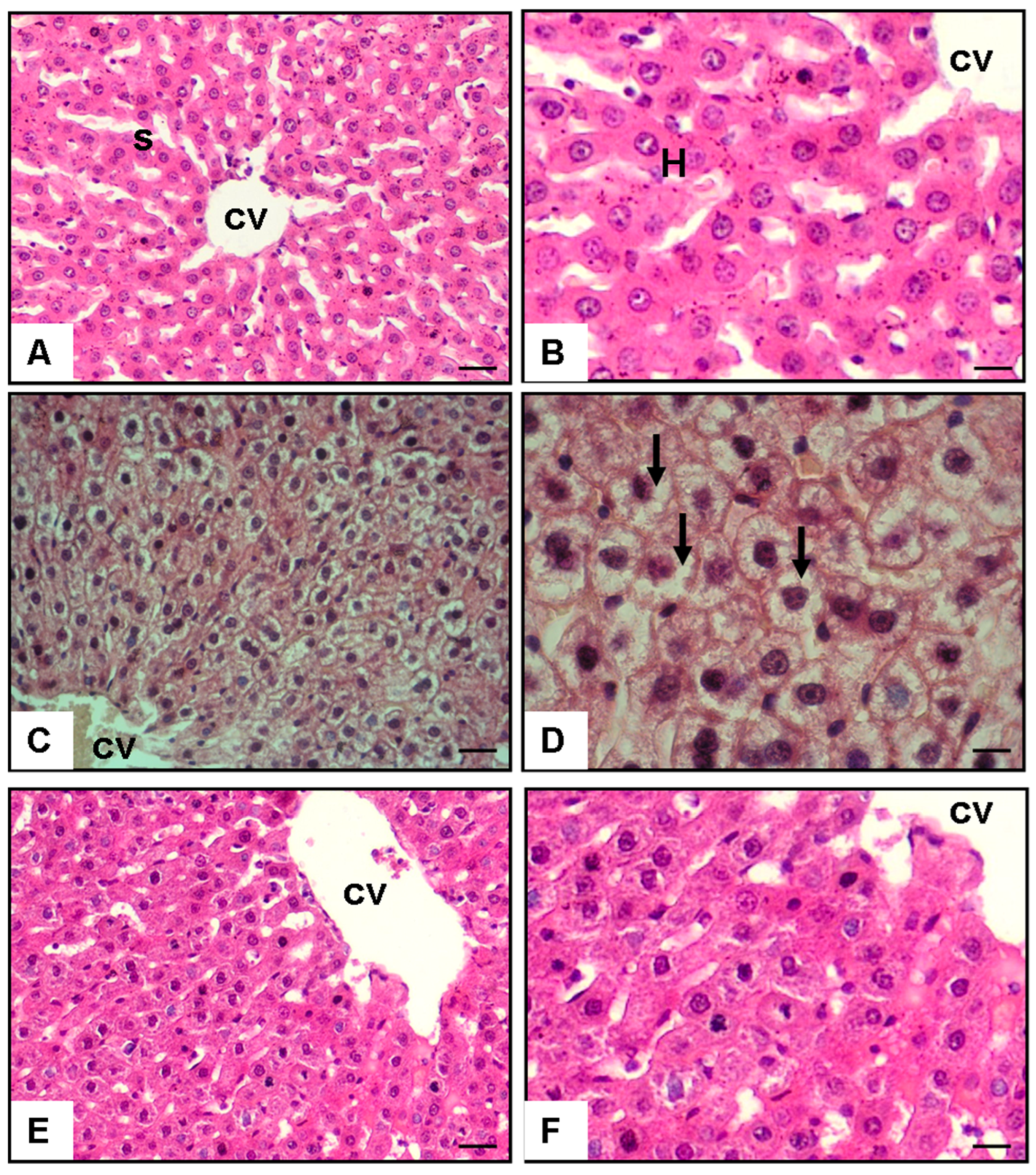 Medicina 60 01713 g001