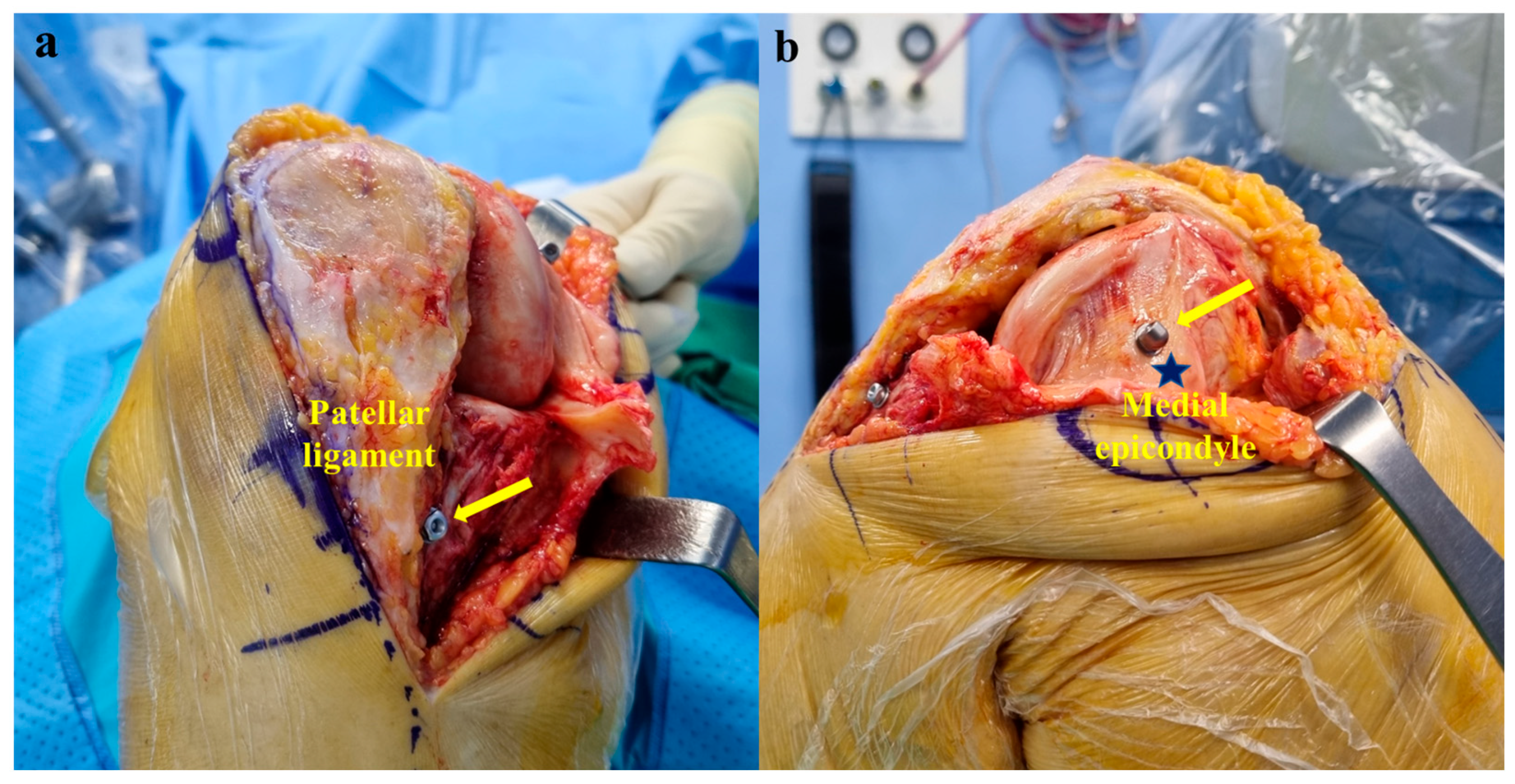 Medicina 60 01720 g002