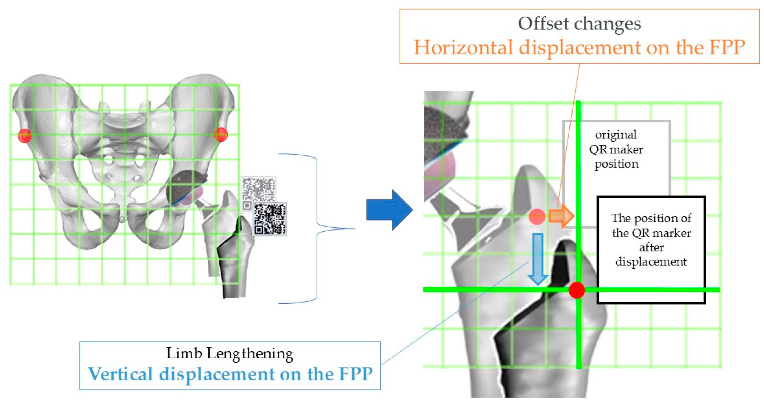 Medicina 60 01721 g006