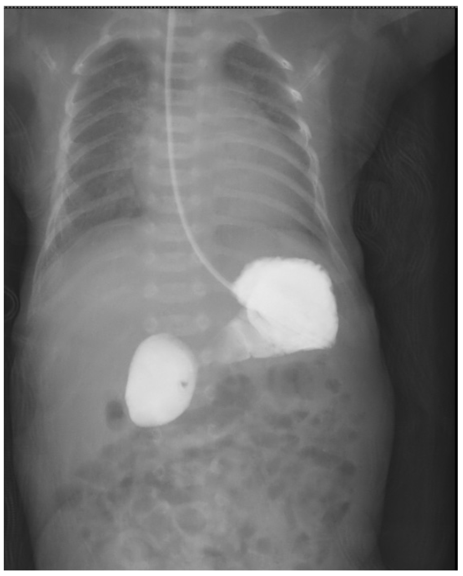 Medicina 60 01722 g002
