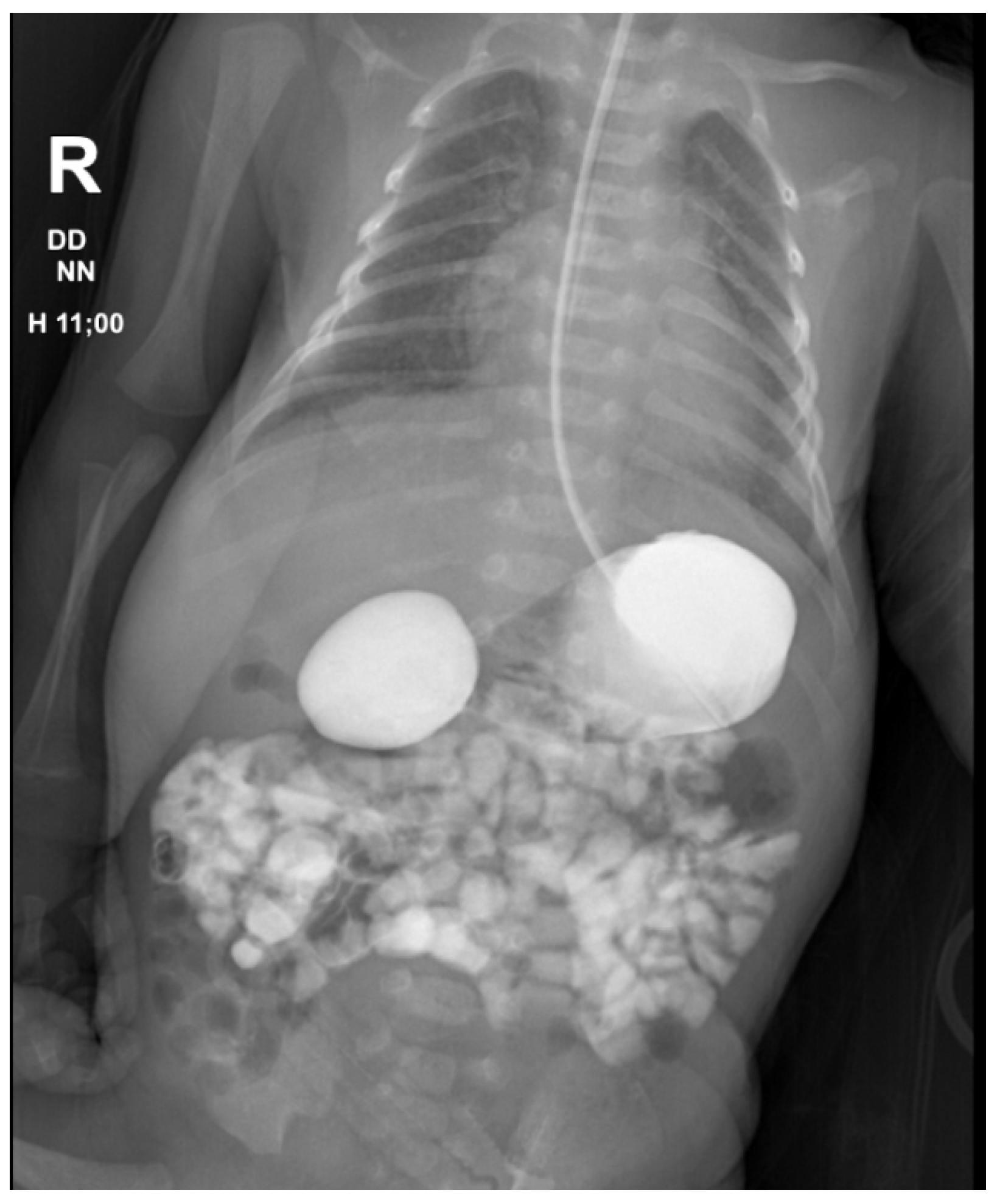 Medicina 60 01722 g003