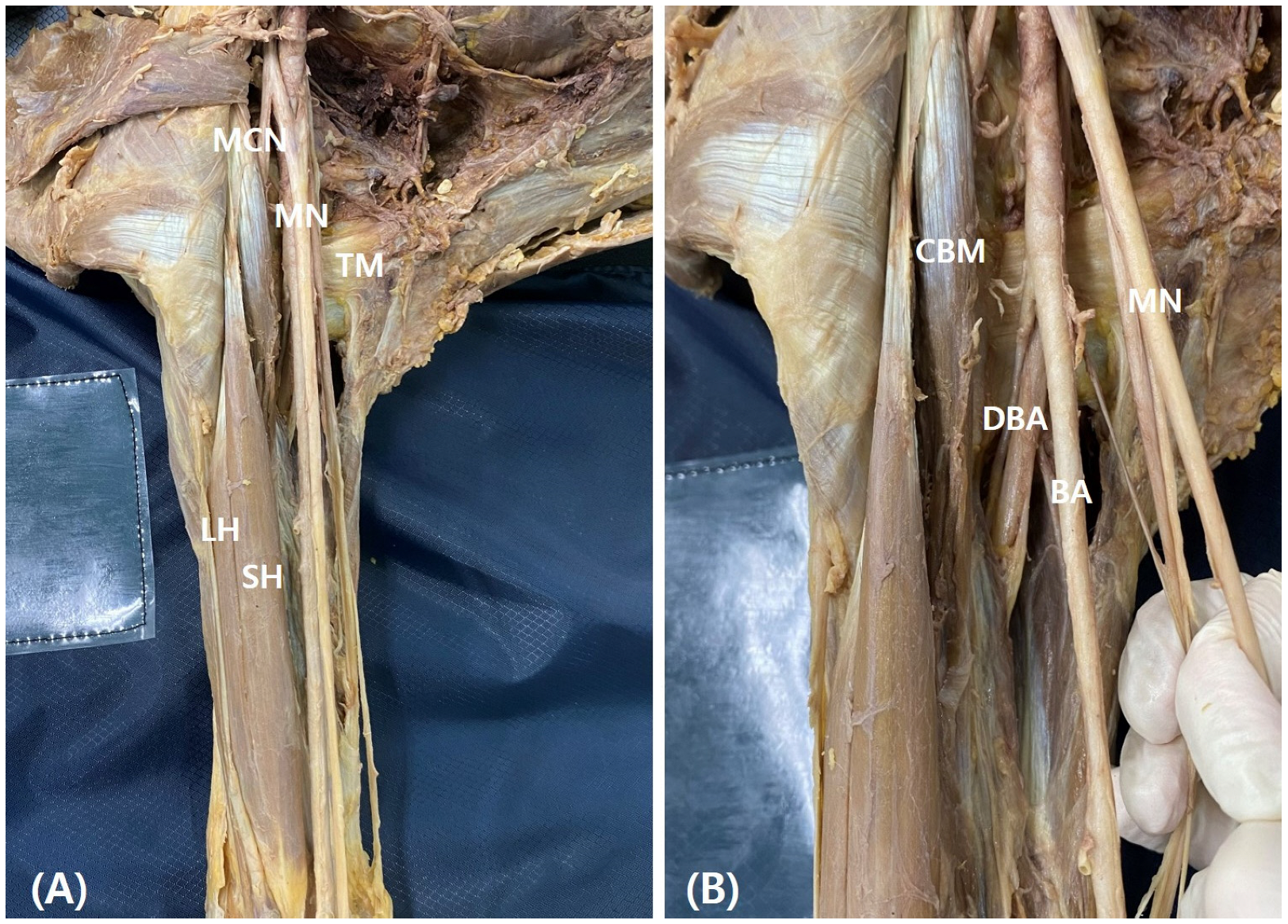 Medicina 60 01726 g001