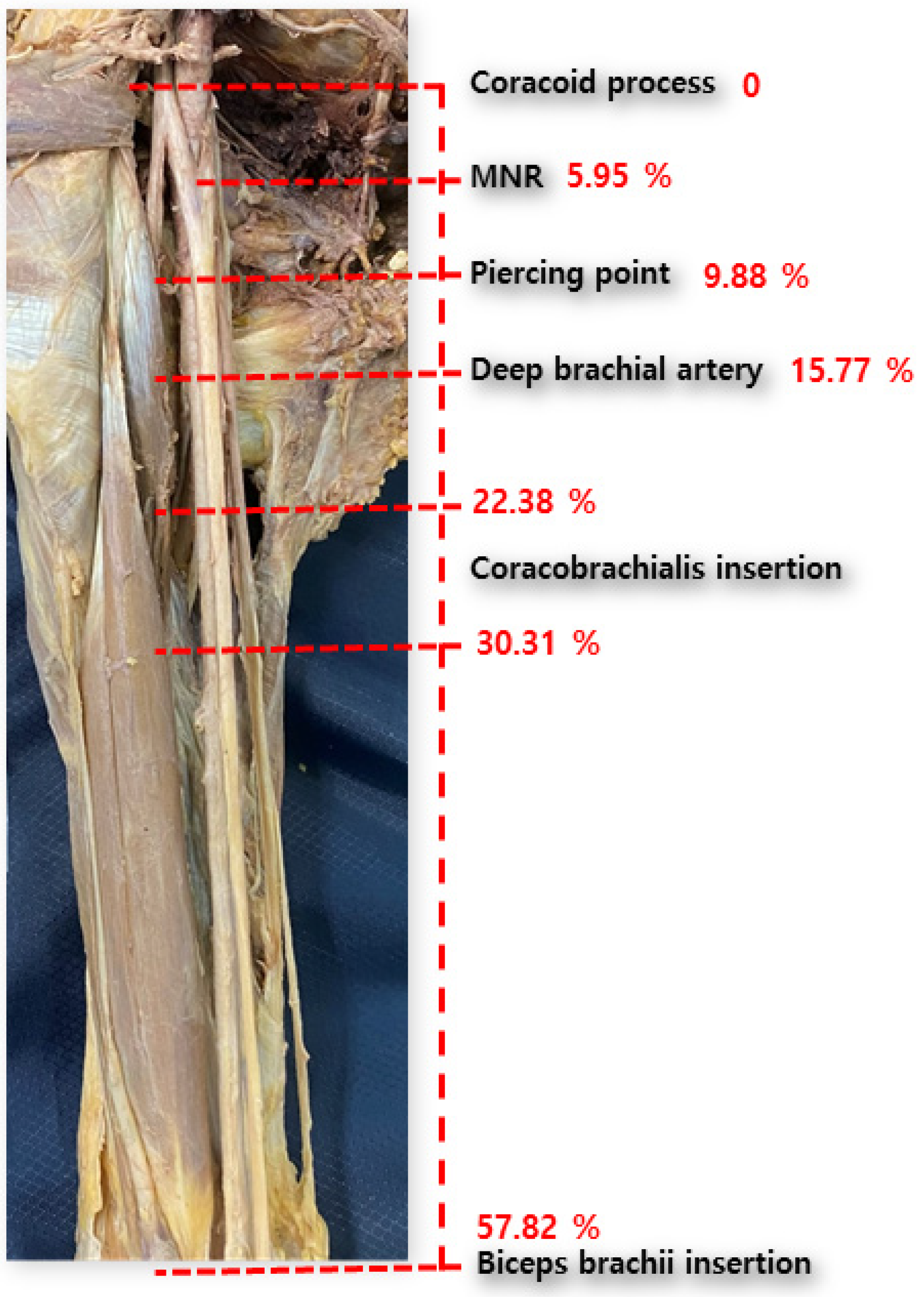 Medicina 60 01726 g002