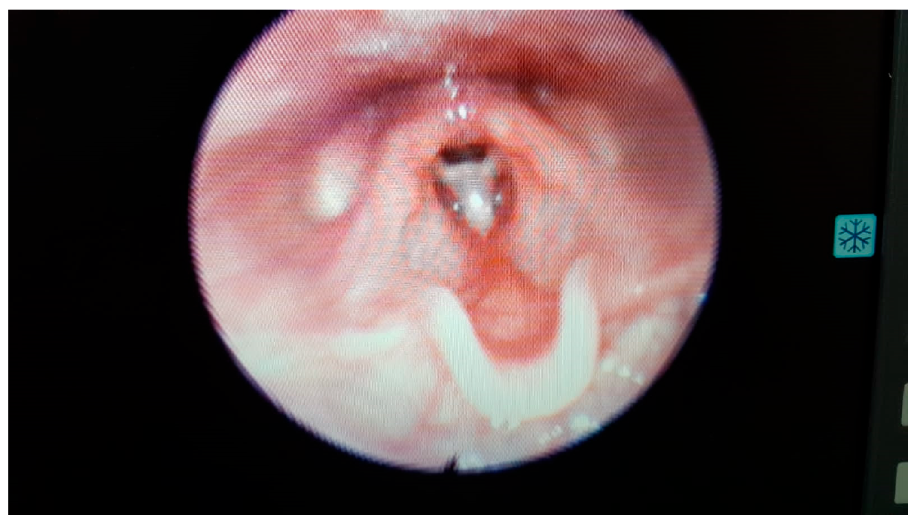 Medicina 60 01729 g002