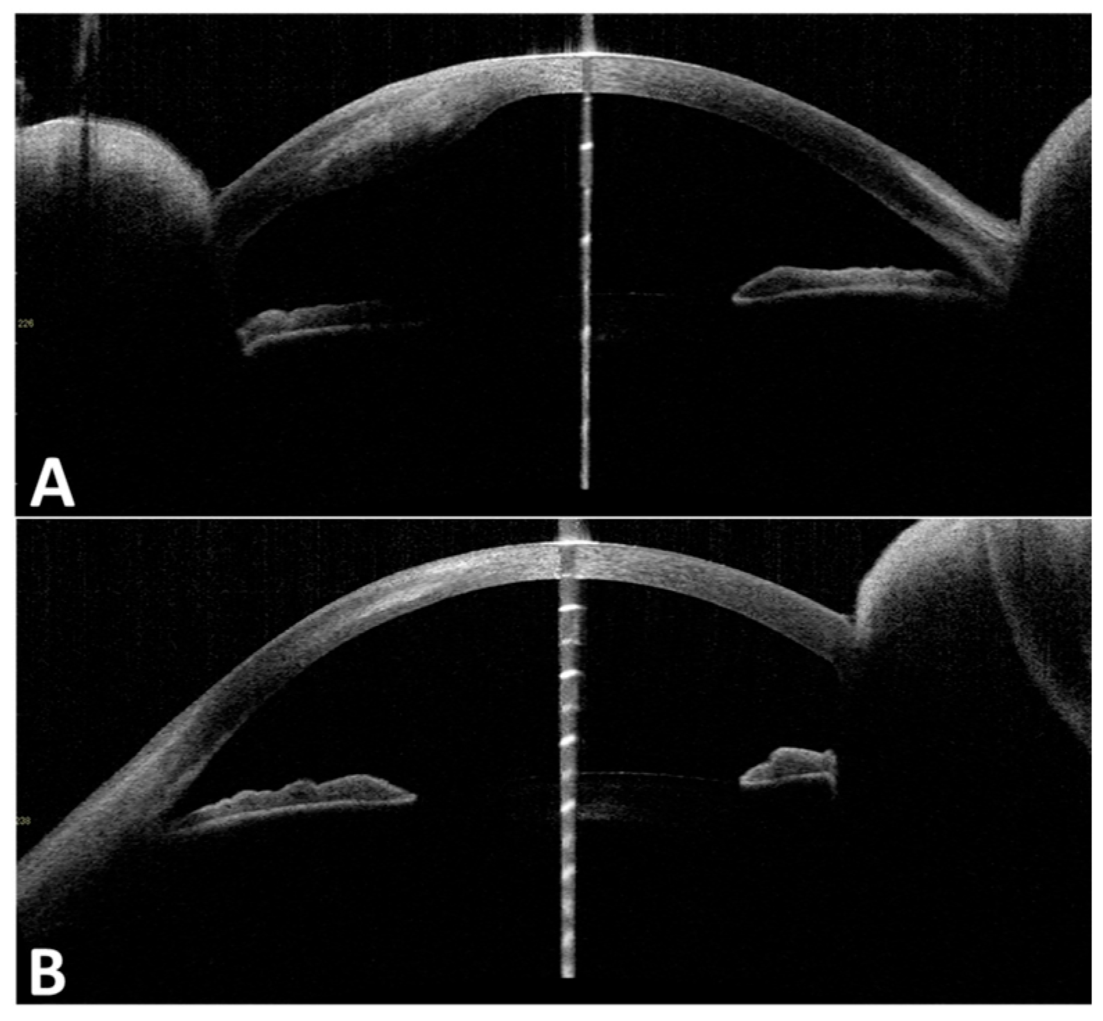 Medicina 60 01730 g002
