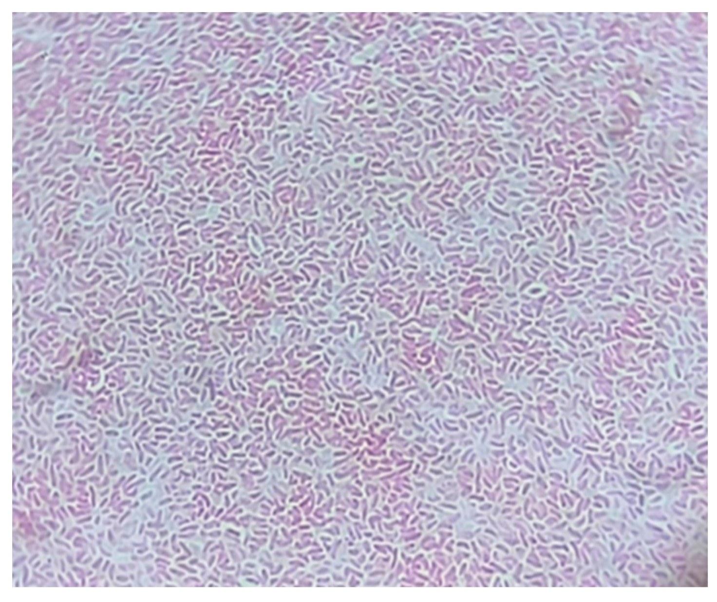 Medicina 60 01748 g002